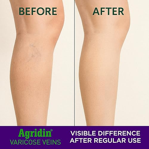 Miniatura 4 de Crema de castaño de indias para piernas y cuerpo - Alivio de las venas varicosas, antihinchazón, soporte de circulación - Enriquecido con aceites de