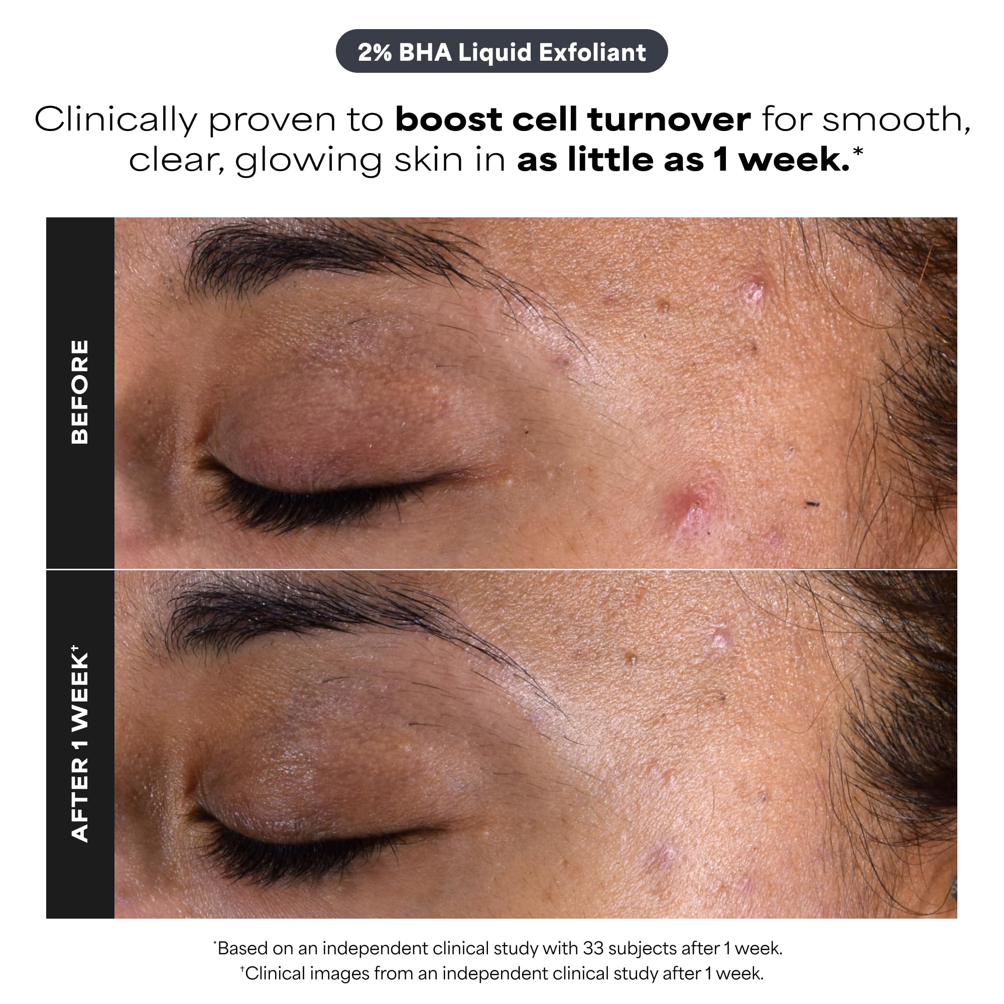 Paula's Choice Kit D'Exfoliants - AHA & BHA Exfoliant Liquide pour une Peau Plus Éclatante - Aide à Réduire les Points Noirs & les Imperfections - avec Acide Salicylique - Tous Types de Peaux