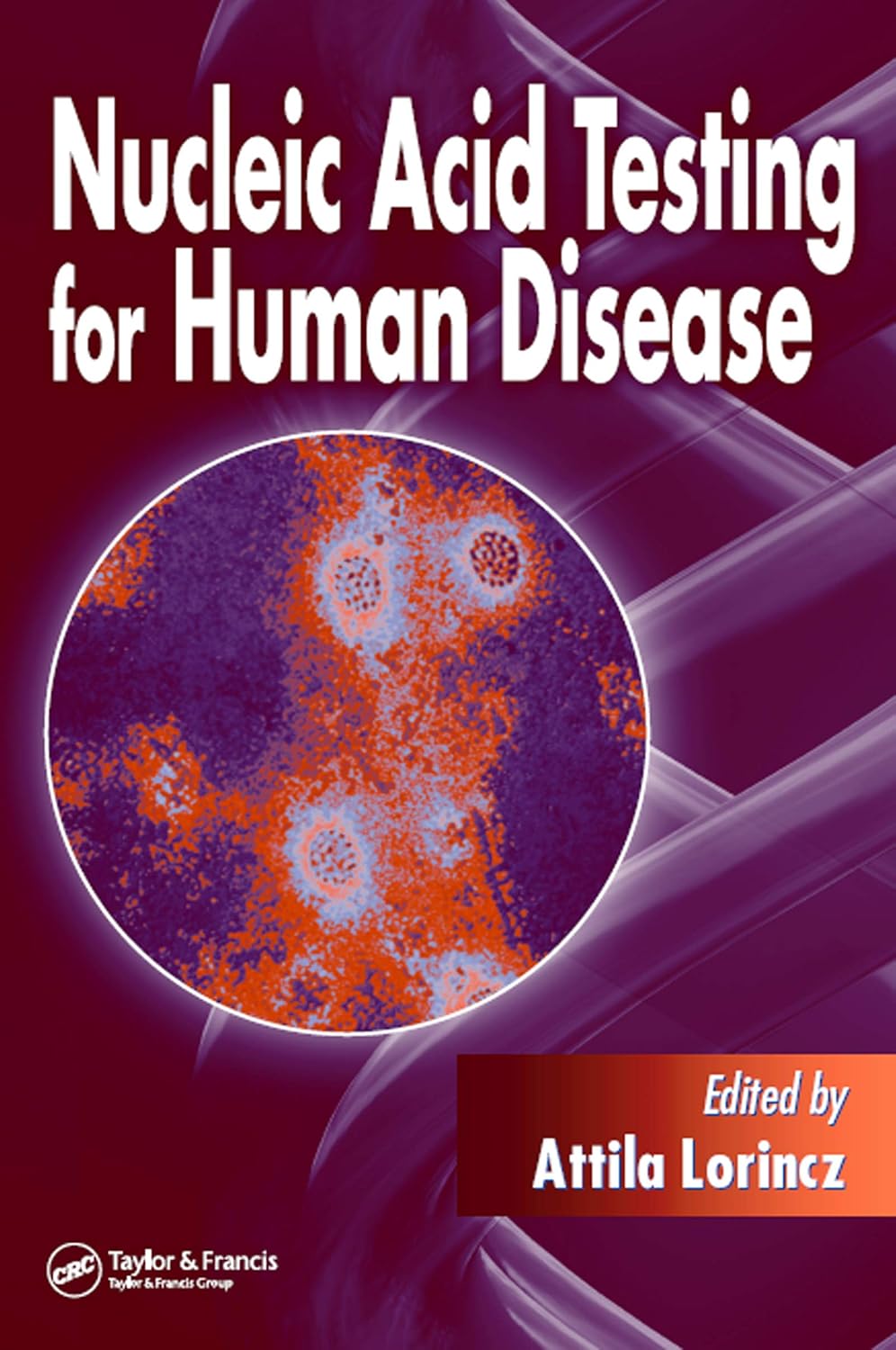 Nucleic Acid Testing for Human Disease      1st Edition, Kindle Edition