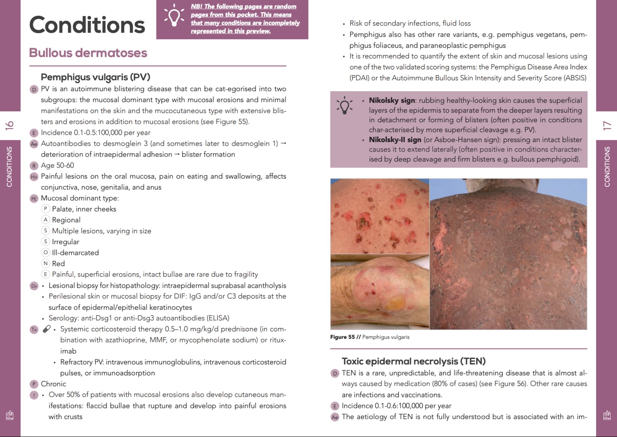 Pocket Dermatology: An essential pocket-sized book on Dermatology.