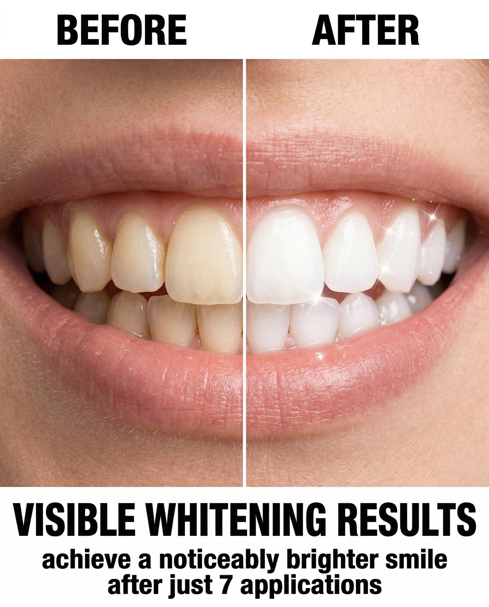 7 pares Tiras Blanqueadoras Dientes, tiras blanqueadoras moradas, profesionales de blanqueamiento de dientes, Whitening Strips, Elimina Manchas Profundas, Para una sonrisa más luminosa