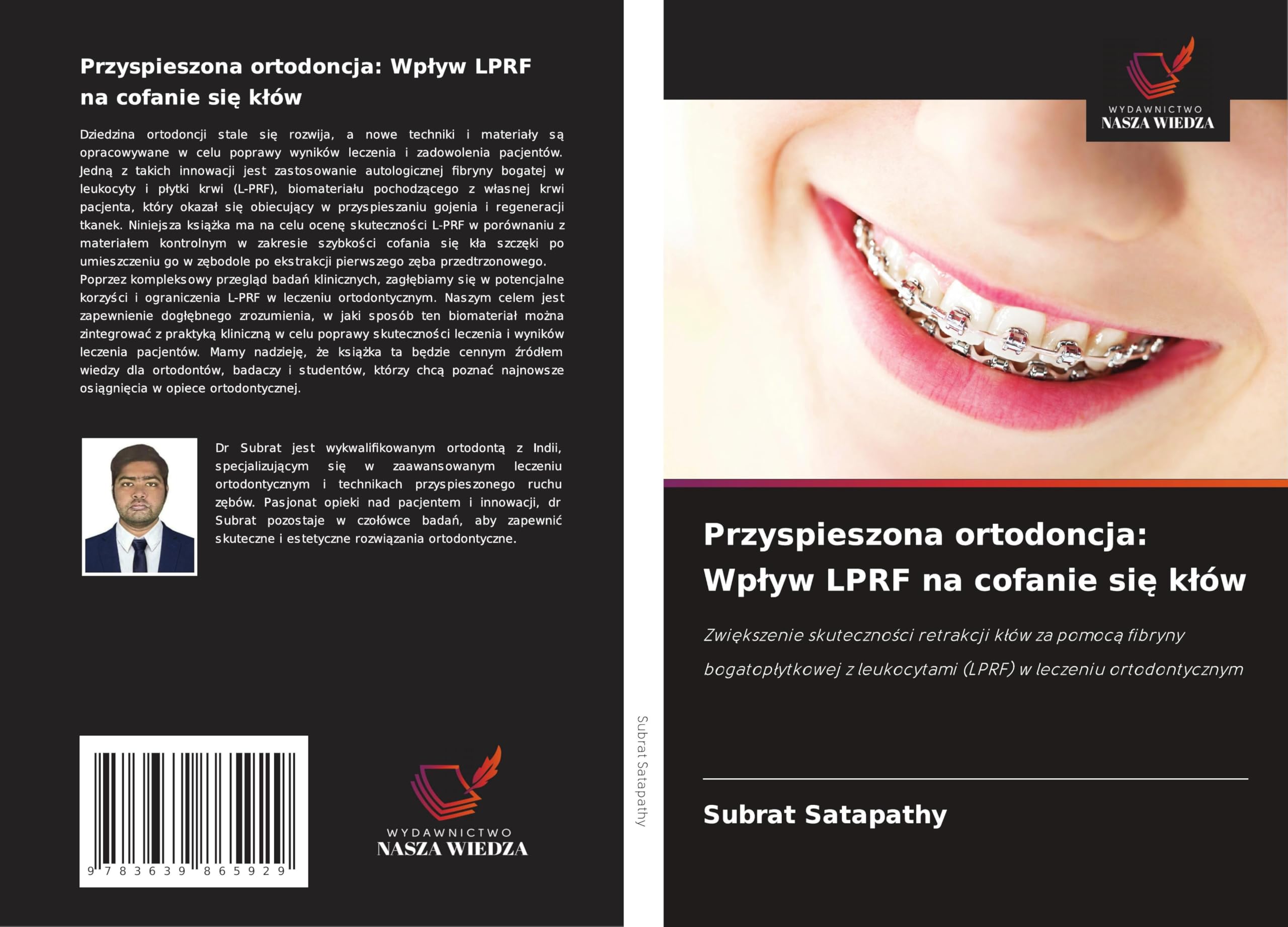 Przyspieszona ortodoncja: Wplyw LPRF na cofanie się klów