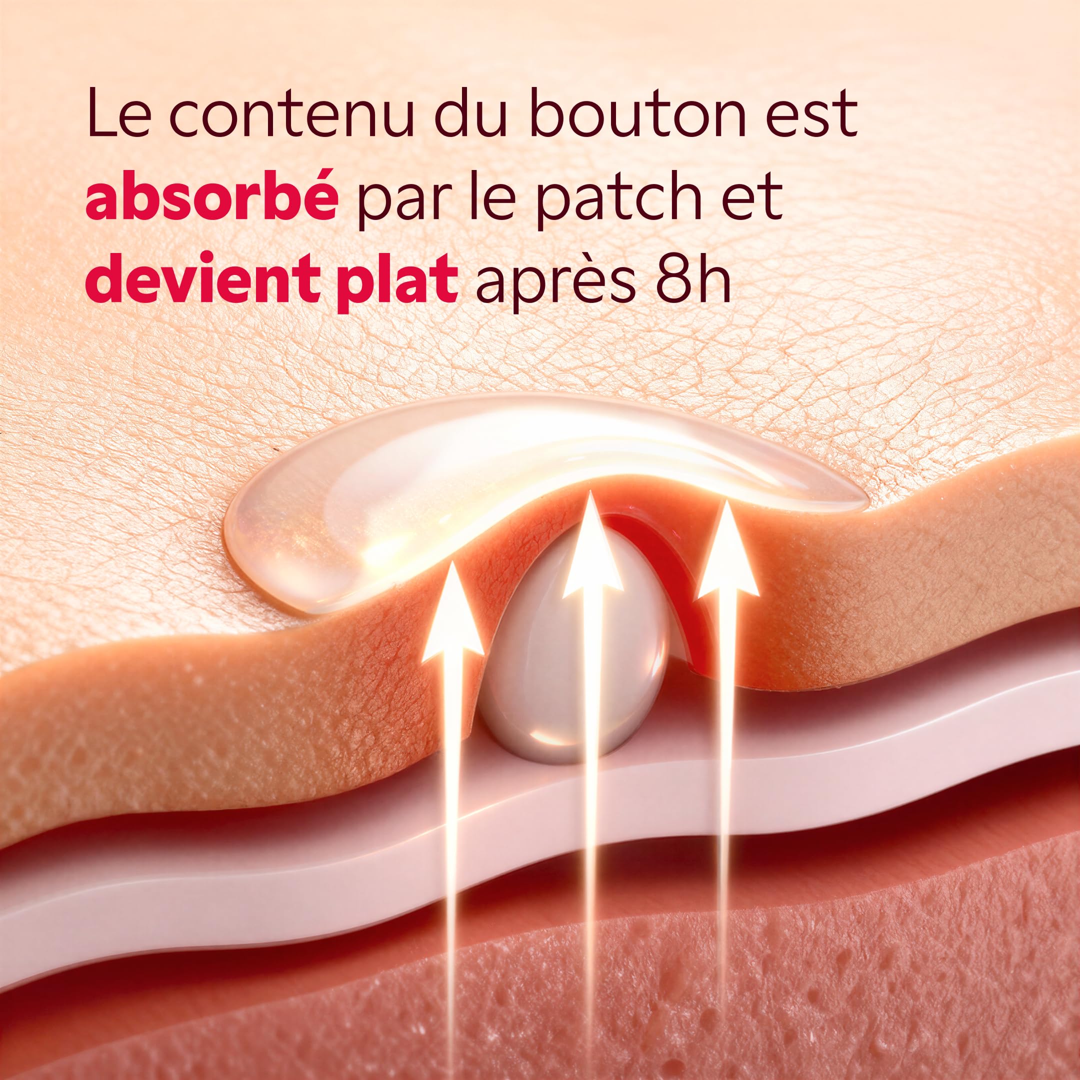Patch Bouton My SOS Beauty - Pack de 36 Patchs - Patch Hydrocolloïde - Absorbe le Sébum et Réduit les Boutons en 8H - Résultats dès la Première Nuit - Boutons Blancs - Invisible et Fin