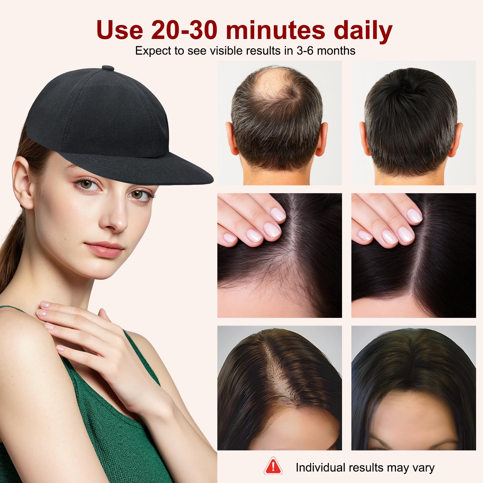 Gorra láser LLLT para crecimiento del cabello – Luz roja e infrarroja 660/850/940 nm, 5 niveles, temporizador
