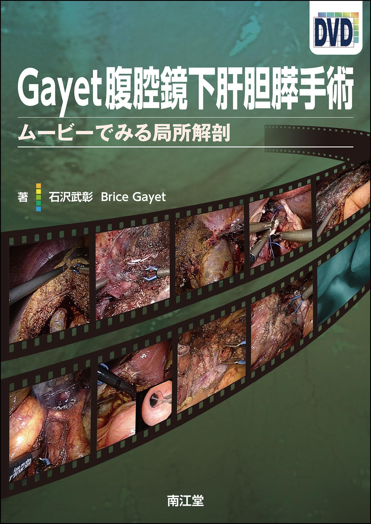 Gayet腹腔鏡下肝胆膵手術(DVD付): ムービーでみる局所解剖 石沢 武彰 81GyiGpfafL.jpg