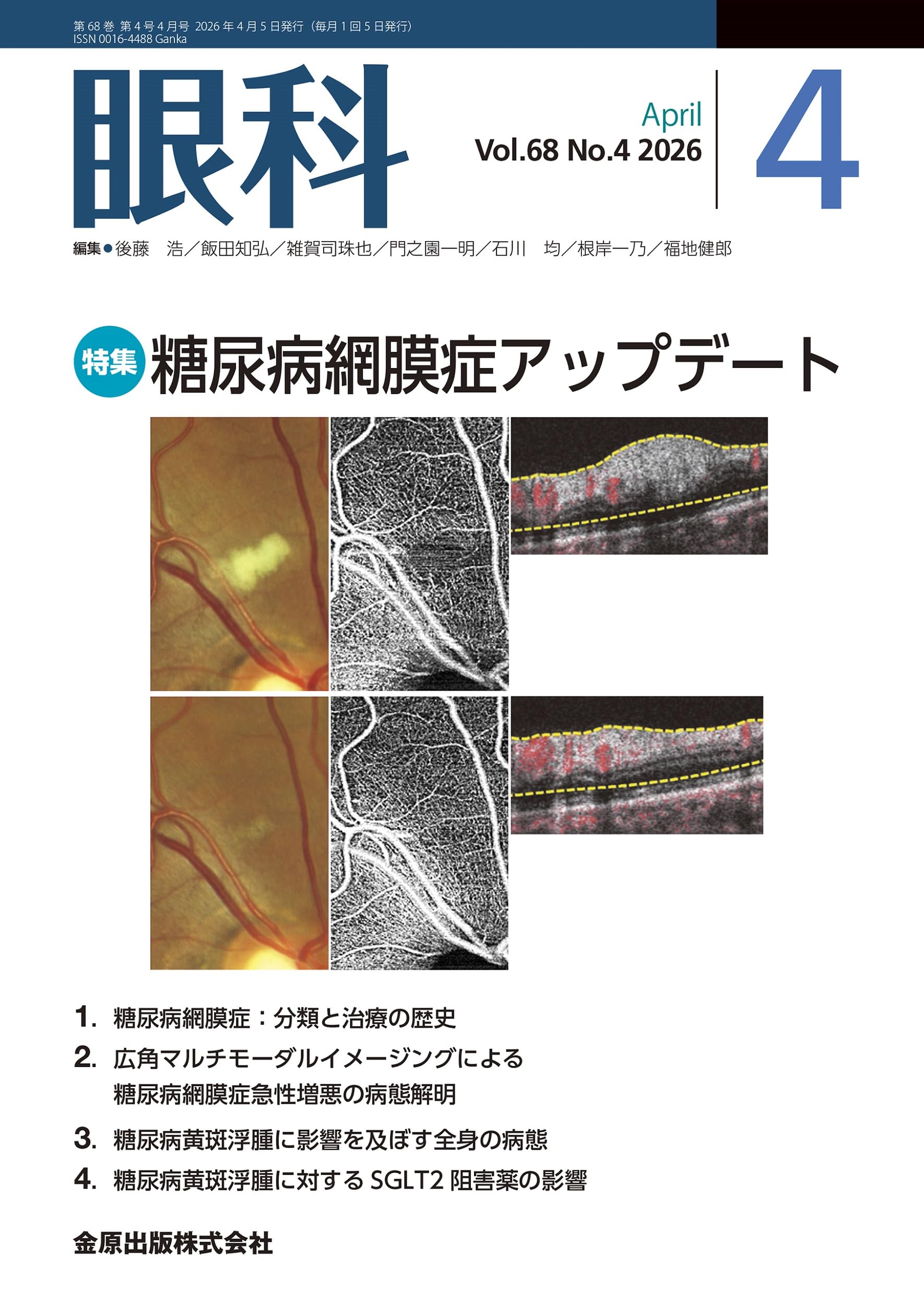眼科 2026年4月号 糖尿病網膜症アップデート | 金原出版 眼科編集室