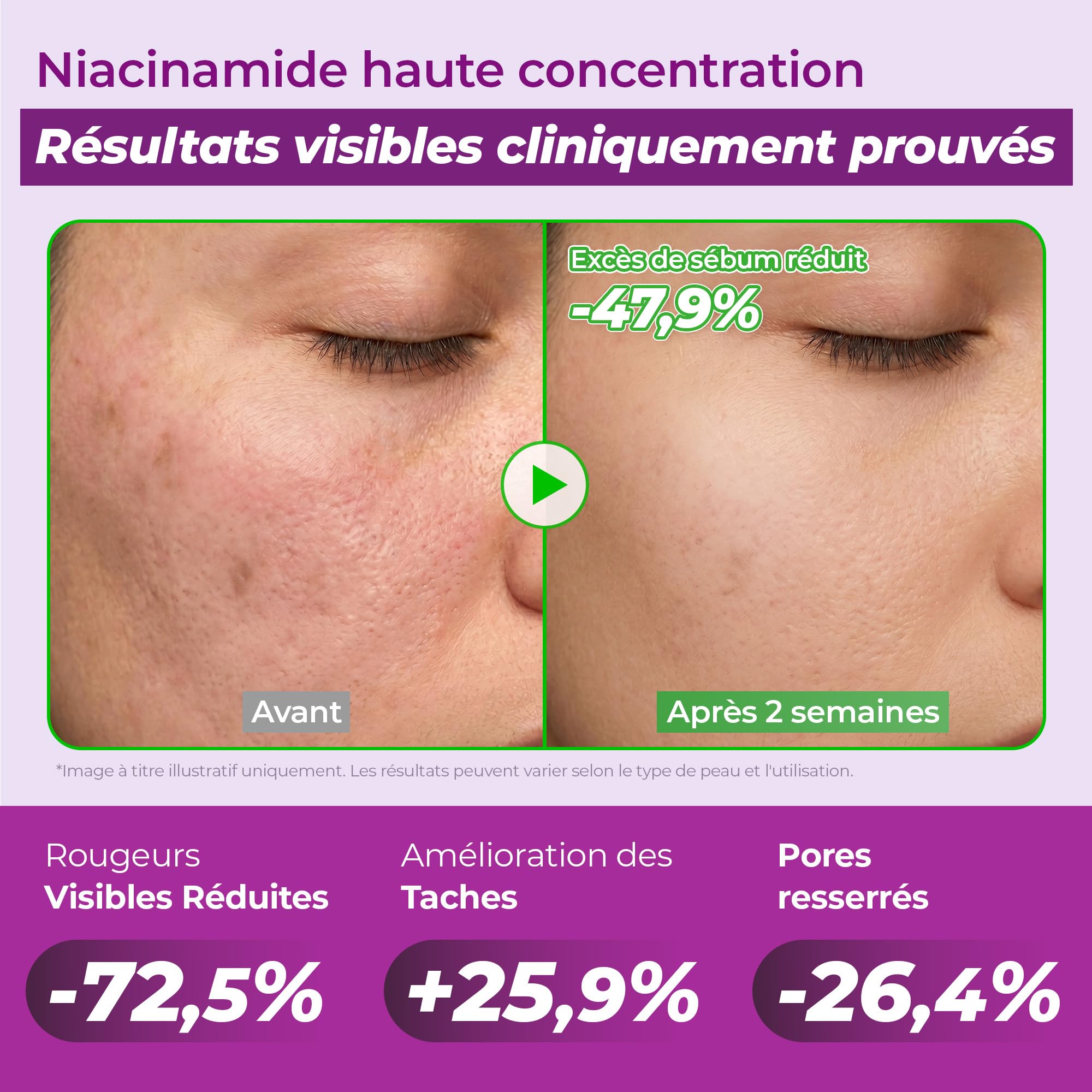 JUMISO Sérum anti-taches brunes 10 % niacinamide - TXA + glutathion - Sérum éclaircissant pour le visage pour un usage quotidien - Gel d'eau sans boulochage - Aide à unifier le teint de la peau