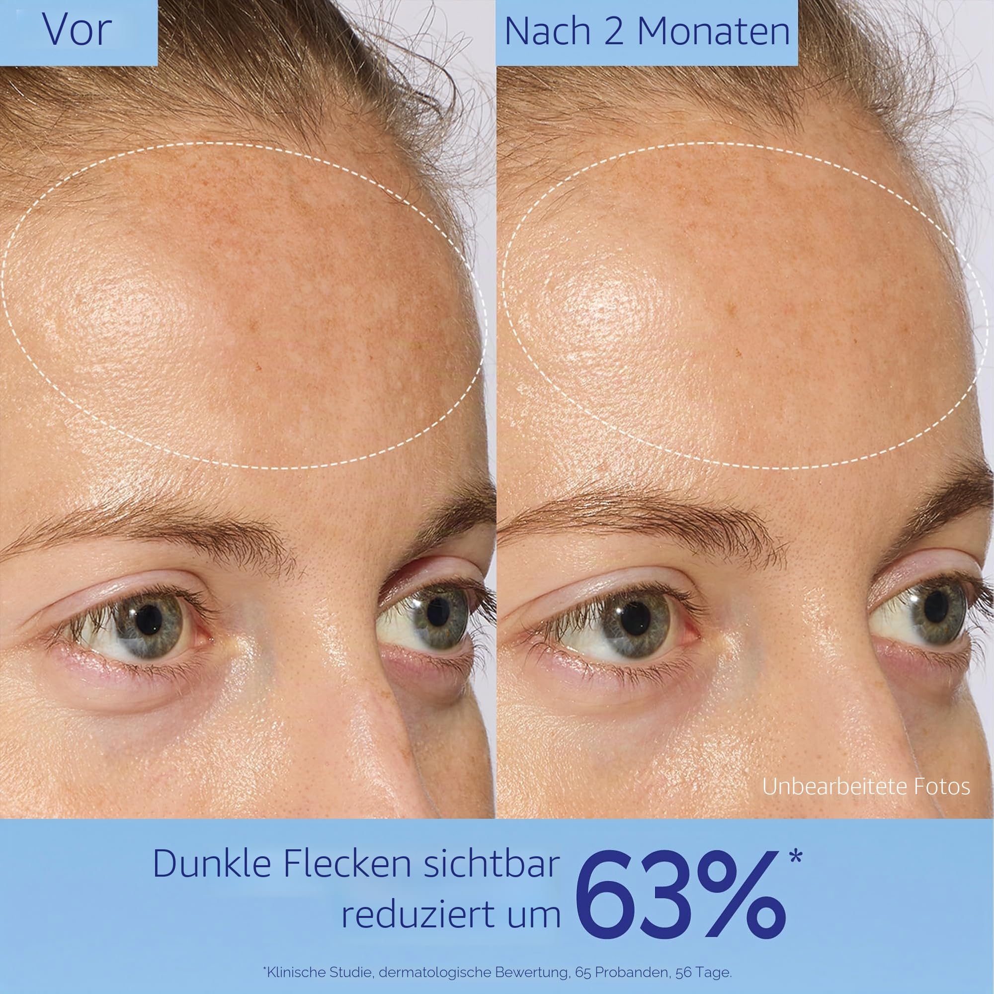 Caudalie Vinoperfect Anti-Pigmentflecken Serum mit Viniferine, 50 ml