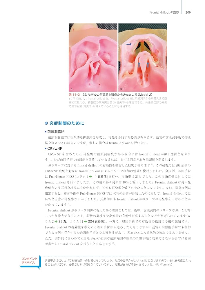 Amazon.co.jp: ウォーモルド直伝 内視鏡下鼻副鼻腔手術