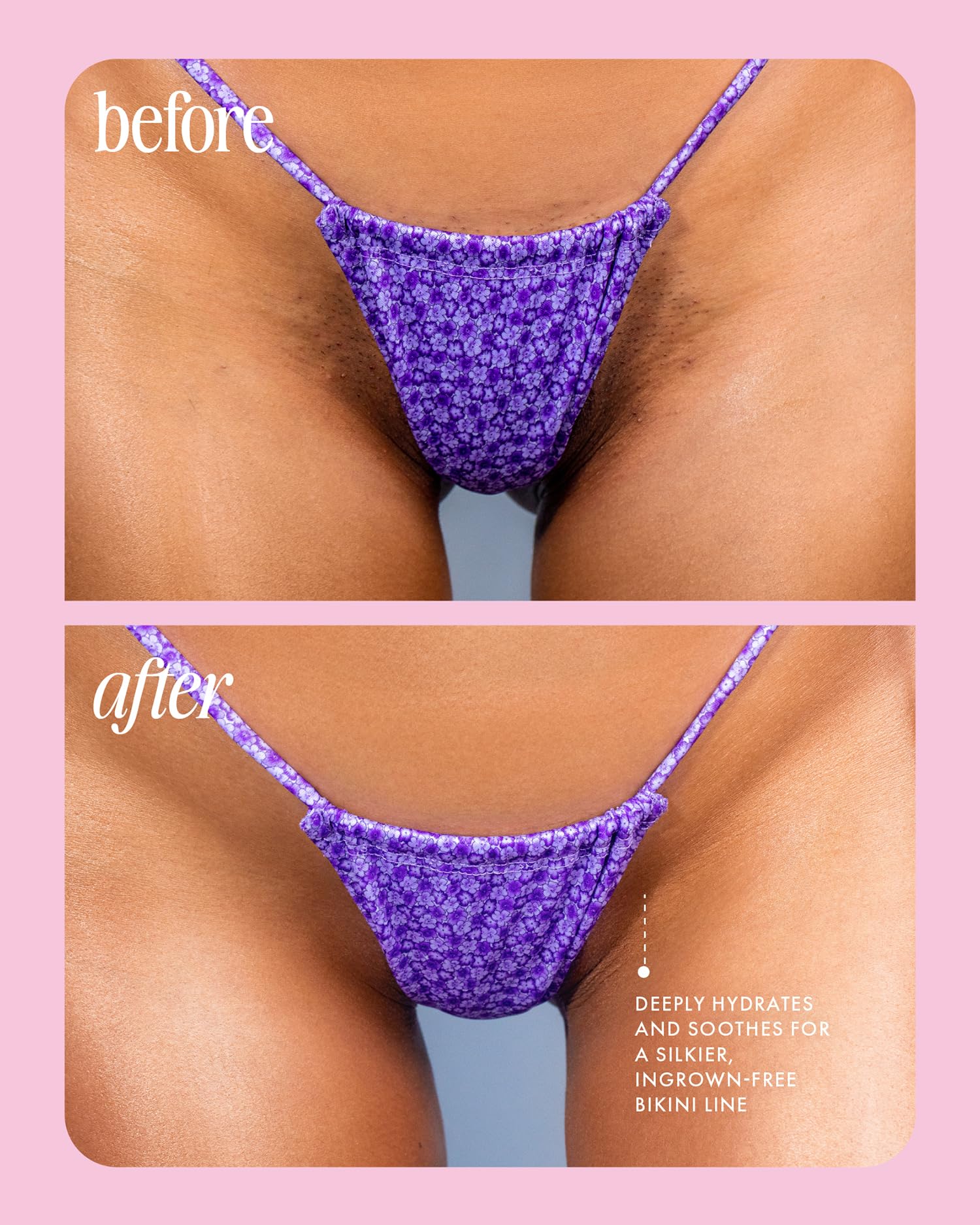 Truly Cooka Collection | Soothing & Hydrating Treatment for Sensitive Areas | Prevents Irritation and Ingrown Hair in Bikini Line & Intimate Areas