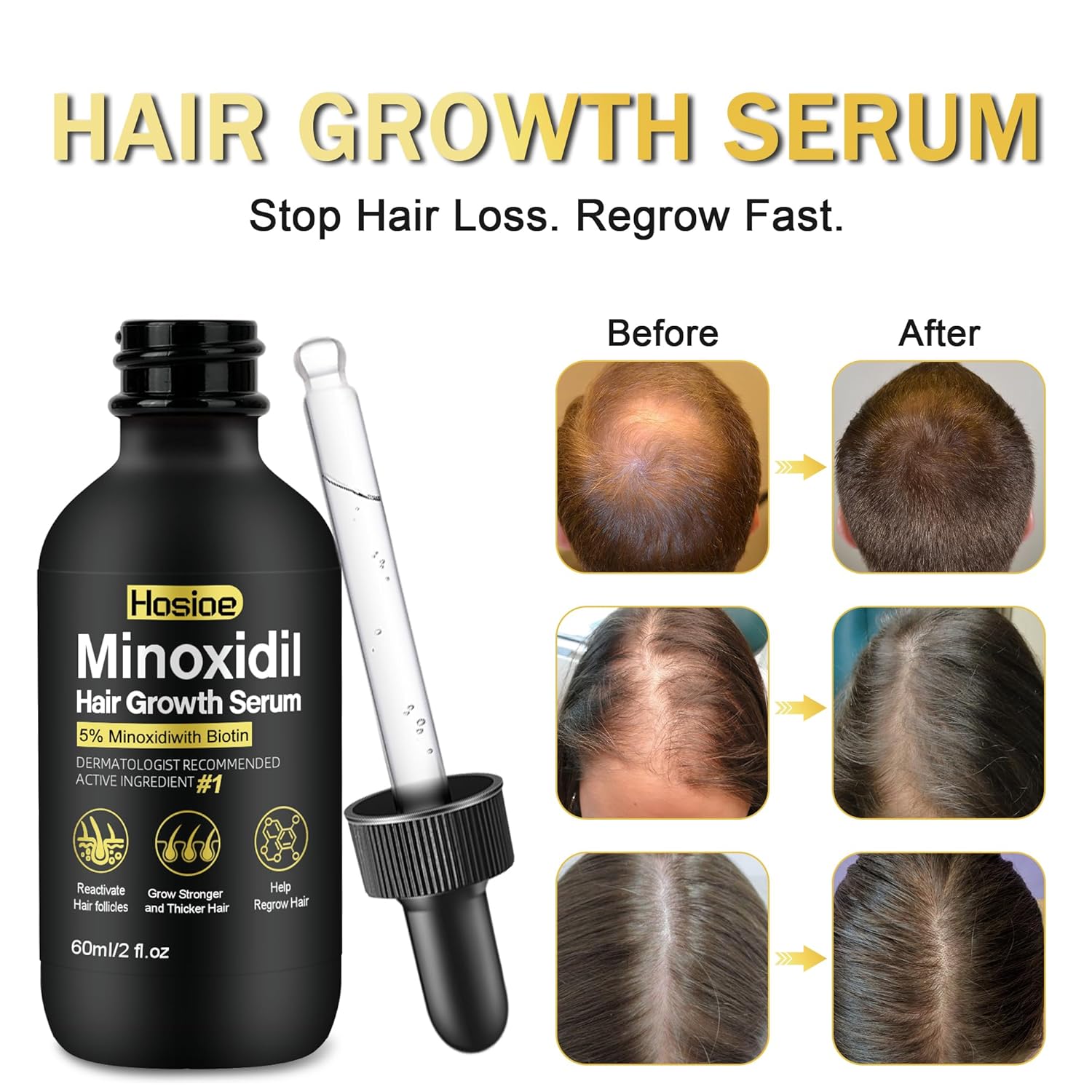 5% Minoxidil Hair Growth Serum for Men and Women Hair Regrowth Treatment,Topical Minoxidil for Beard Growth(3Packs)
