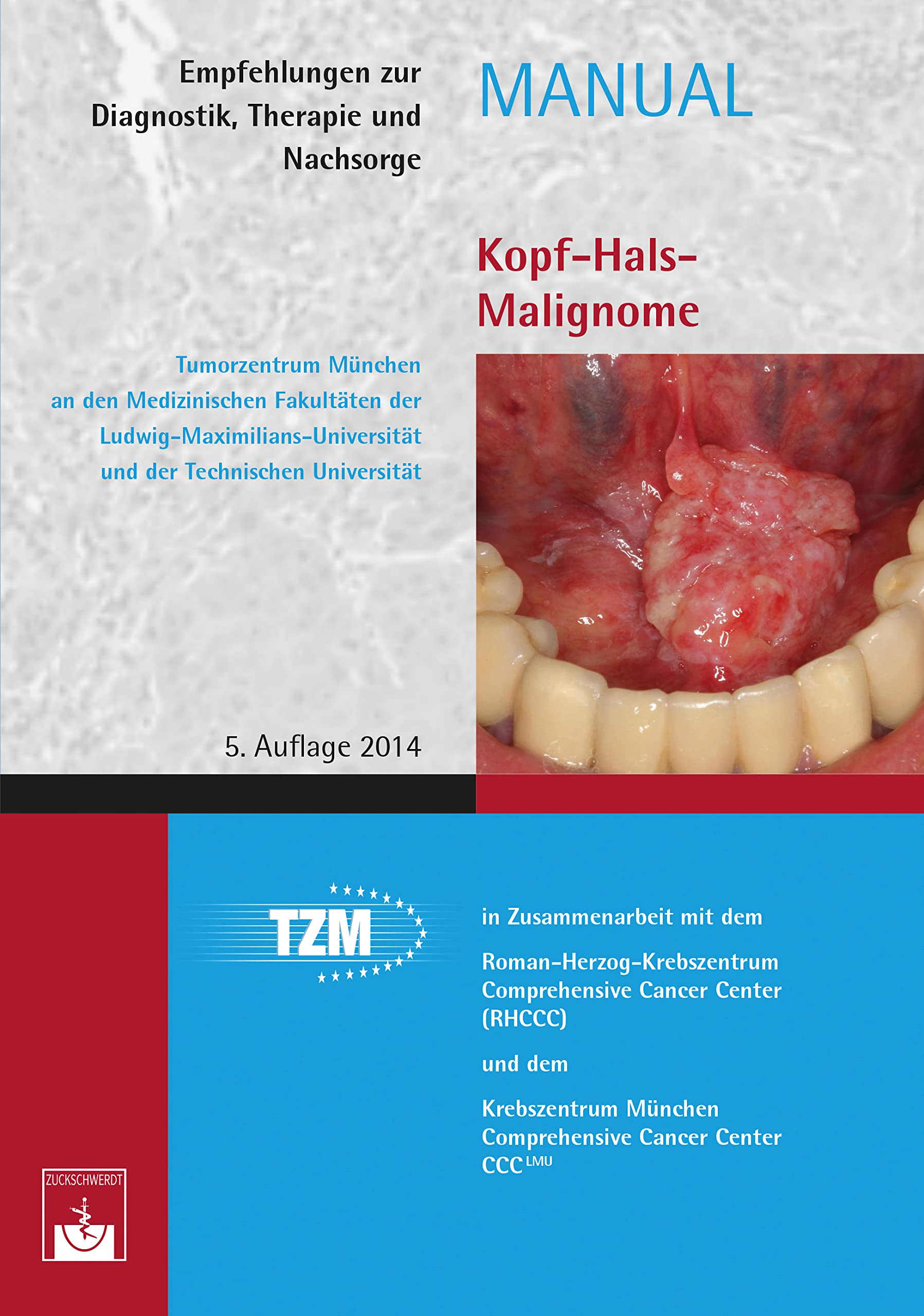 Kopf-Hals-Malignome: Empfehlungen zur Diagnostik, Therapie und Nachsorge (Manuale Tumorzentrum München)