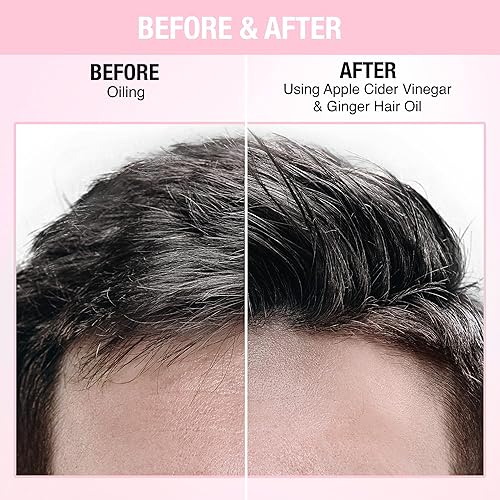 Miniatura 5 de Nykaa Naturals Aceite para el cabello para hombres y mujeres, aceite para el cabello anticaspa con vinagre de sidra de manzana y jengibre, aceite