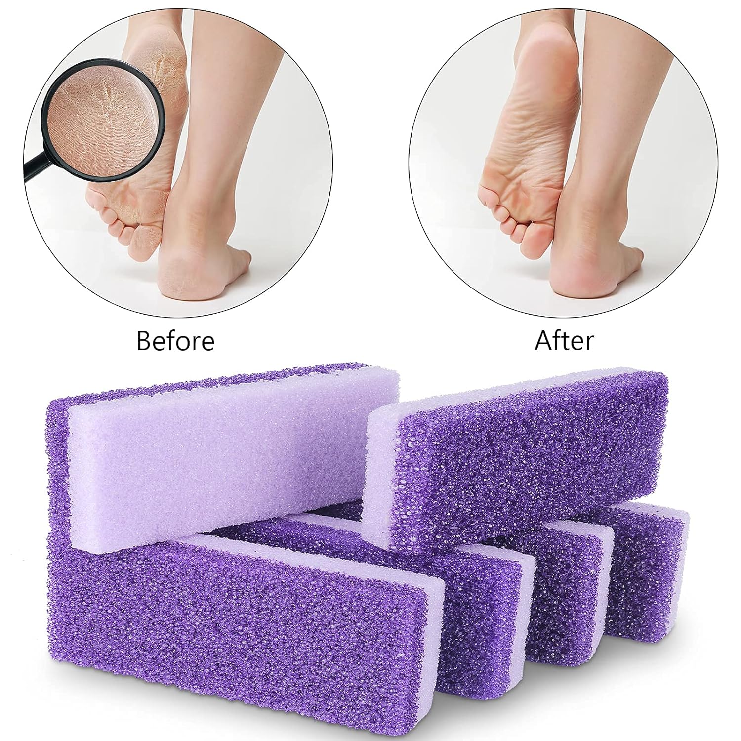 2 in 1 Pumice Stone for Feet,6 Pack Foot Scrubber & Callus Remover, Stone Scrubber for Hard Skin,Foot Pumice,Dead Skin Remover for Feet, Heels, Hands and Body : Beauty & Personal Care