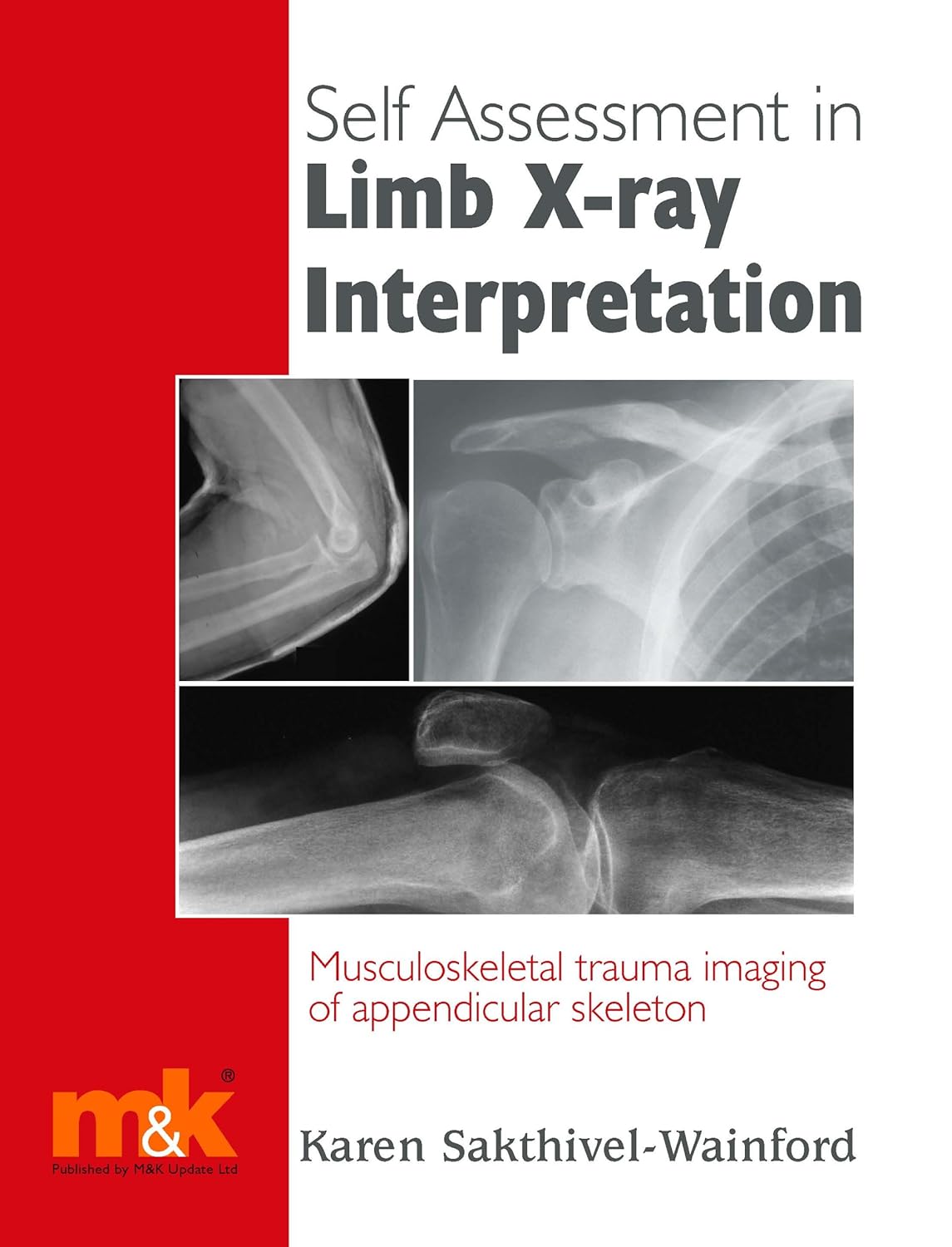 Self Assessment in Limb Xray Interpretation Musculoskeletal Trauma