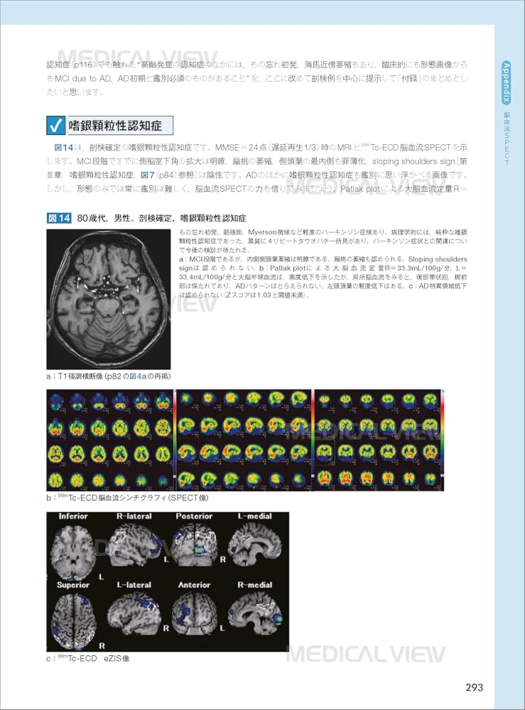 画像で究める認知症診断 メジカルビュー社｜画像医学・放射線医学｜画像で究める認知症