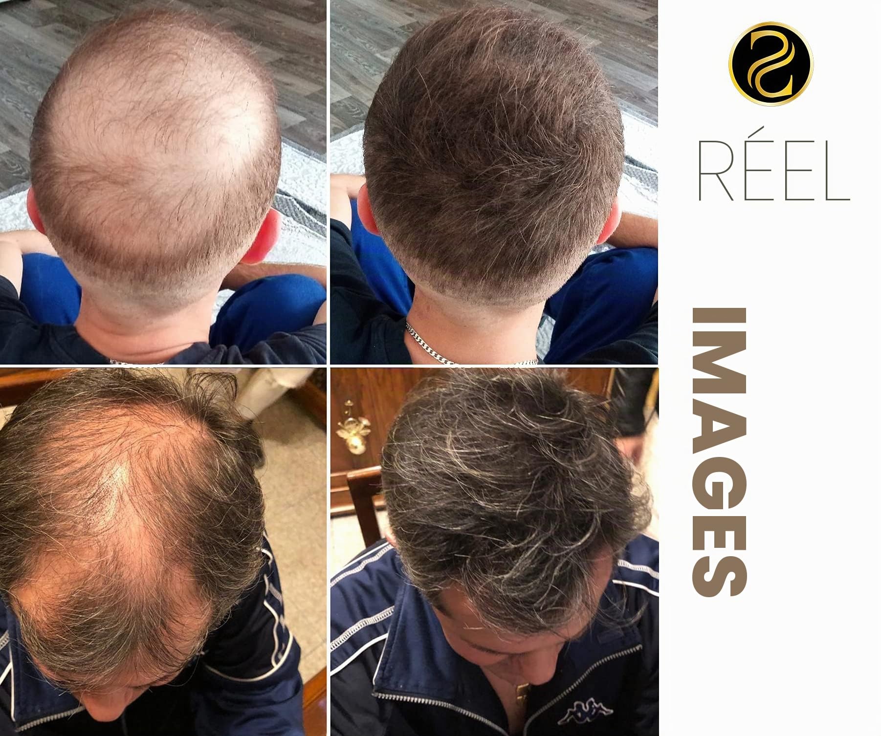 Fibres capillaires densifiantes – Densificateur de cheveux – Effet densité naturel – Pour cheveux fins et clairsemés - brun fonce - 25g