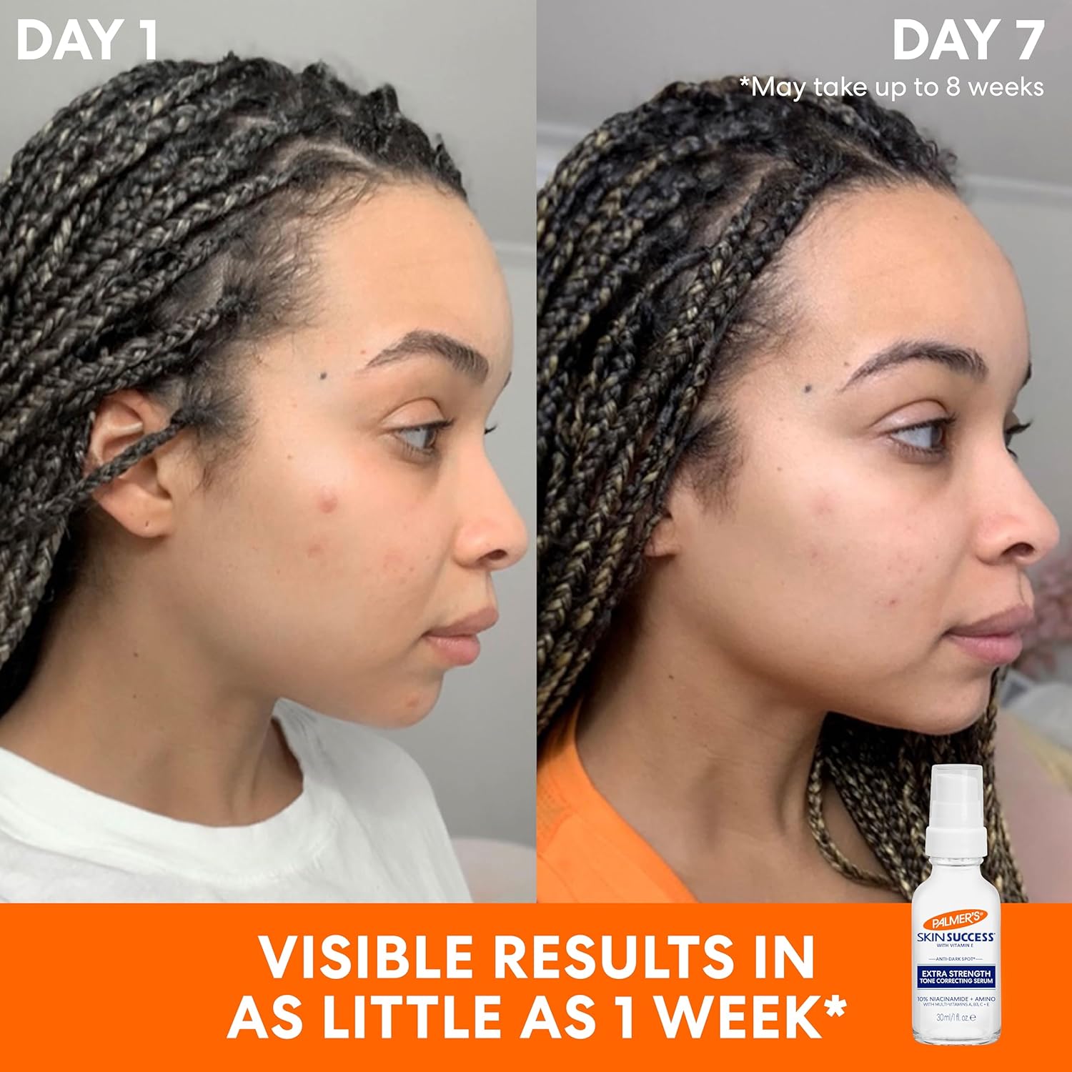 Palmer's Skin Success Extra Strength Tone Correcting Face Serum, 1.0 Fl Oz, Dark Spot Corrector for Discoloration, Age Spots and Post-Acne Marks - Image 3