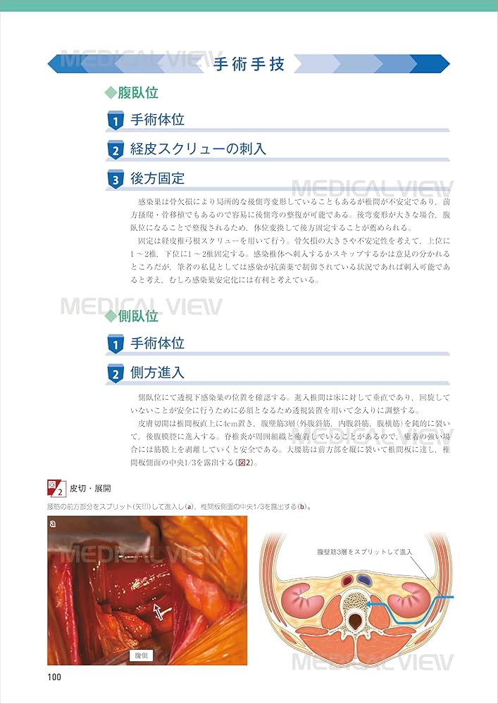 【裁断済み】OS NEXUS13 脊椎の再建法―すべり症から脊柱変形まで 裁断済み】OS NEXUS13 脊椎の再建法―すべり症から脊柱変形まで