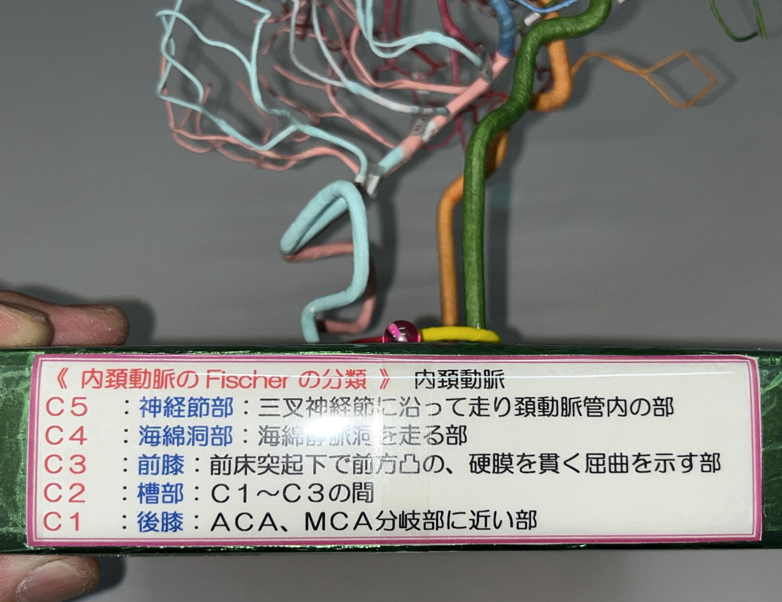 Amazon.co.jp: 脳血管模型：教育用（オリジナルプロダクト） : 産業