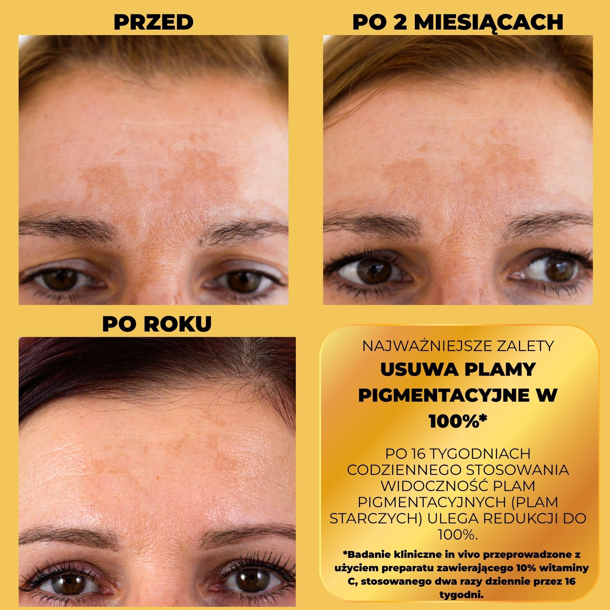 Afrodita Professional C10 serum z witaminą Super Shot | 10% stabilizowana witamina C serum do twarzy przeciw plamom pigmentowym | Rozjaśniające serum przeciw starzeniu się skóry z efektem świecenia