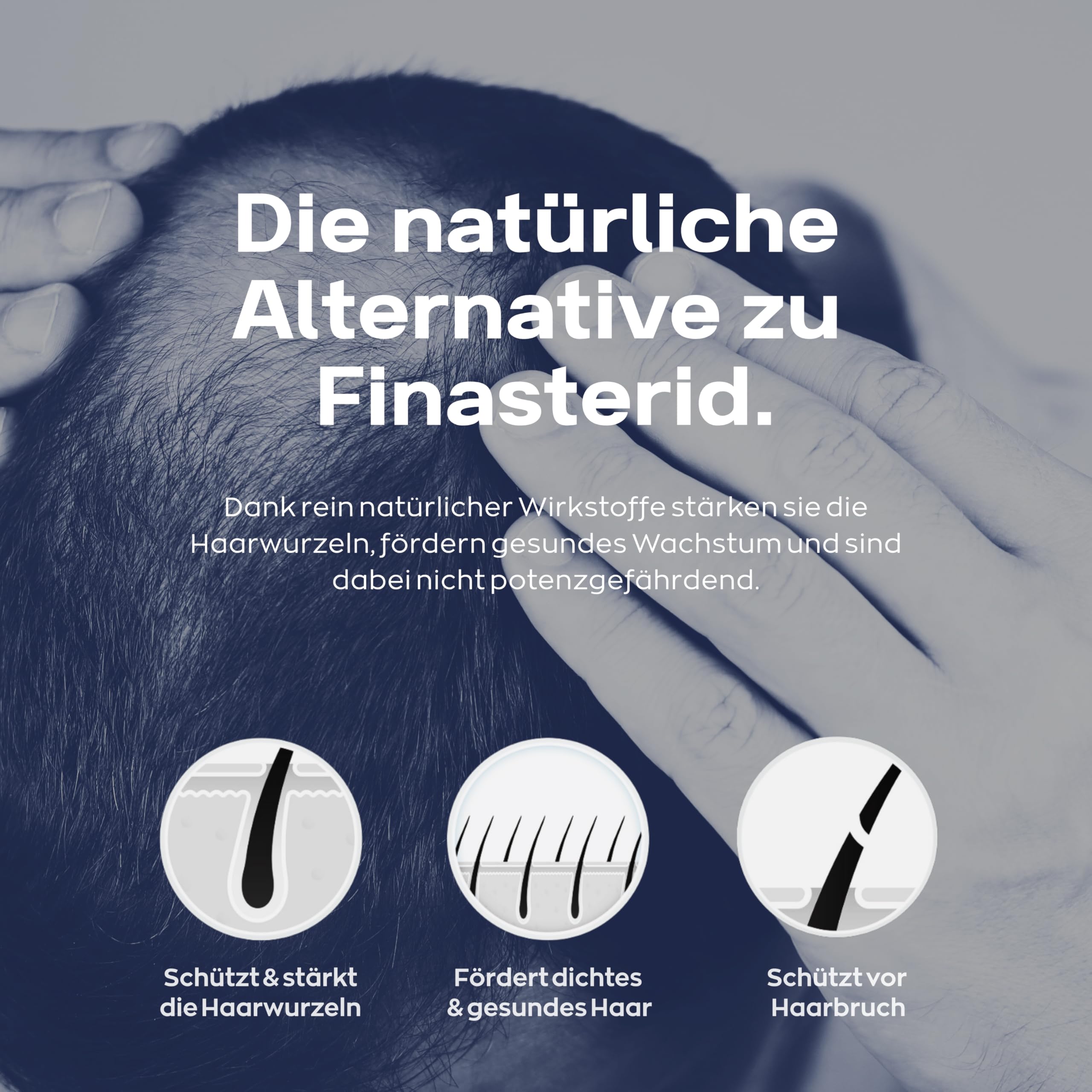 Xpecia DHT Blocker mit Biotin und Sägepalmextrakt - Gegen Haarausfall Männer - Ginko Wurzel, Haar Vitamine, Sägepalme - Haarwachstum beschleunigen - Nachbehandlung Haartransplantationen