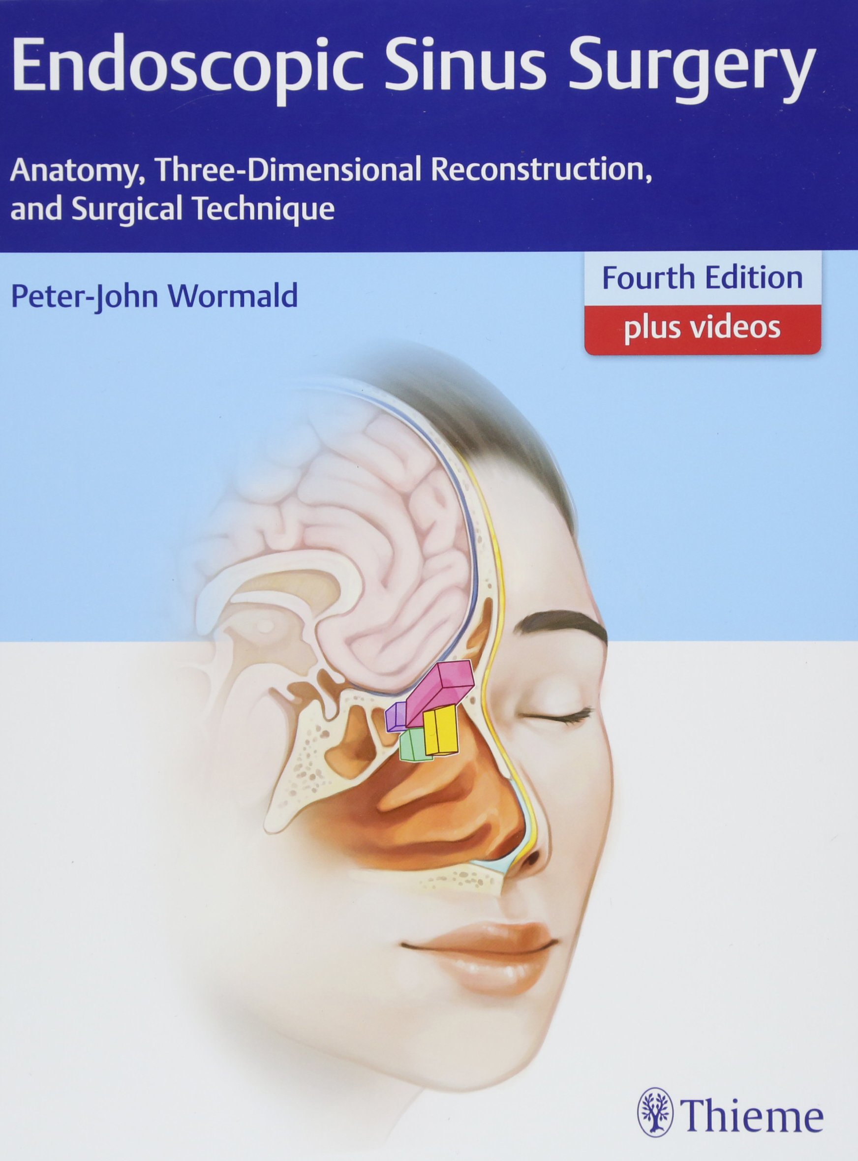 Buy Endoscopic Sinus Surgery Anatomy, ThreeDimensional Reconstruction