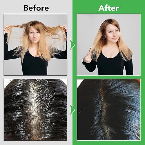 Miniatura 6 de Acondicionador de romero para el crecimiento del cabello, acondicionador fortalecedor de menta de romero, acondicionador de rutina para mujeres