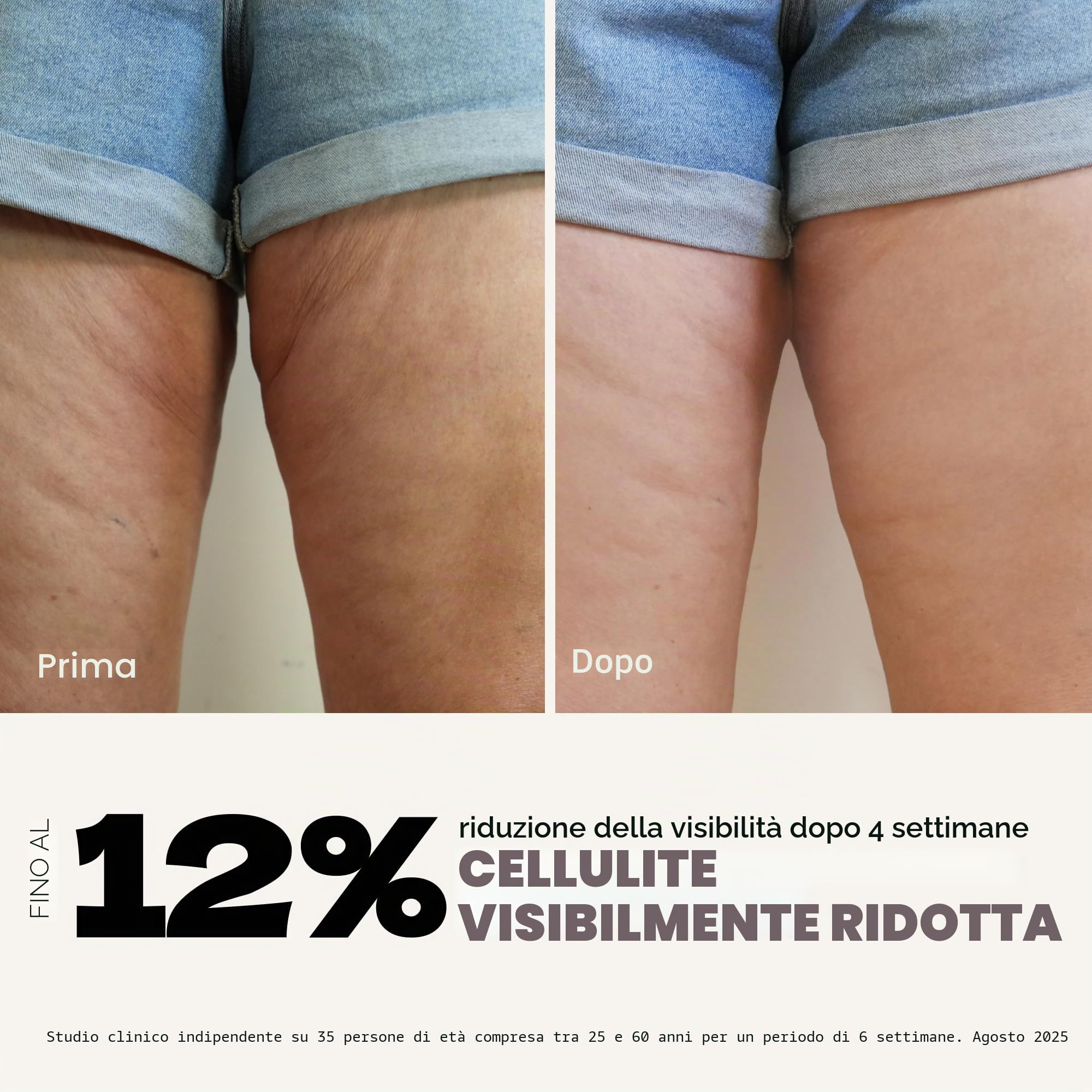 Magnitone Diablo Pro Apparecchio per la Scultura Integrale del Corpo – Microcorrente EMS, Radiofrequenza e Massaggio – 3 Livelli di Intensità – Senza Fili, Portatile, Batteria da 70 Min – per Gambe
