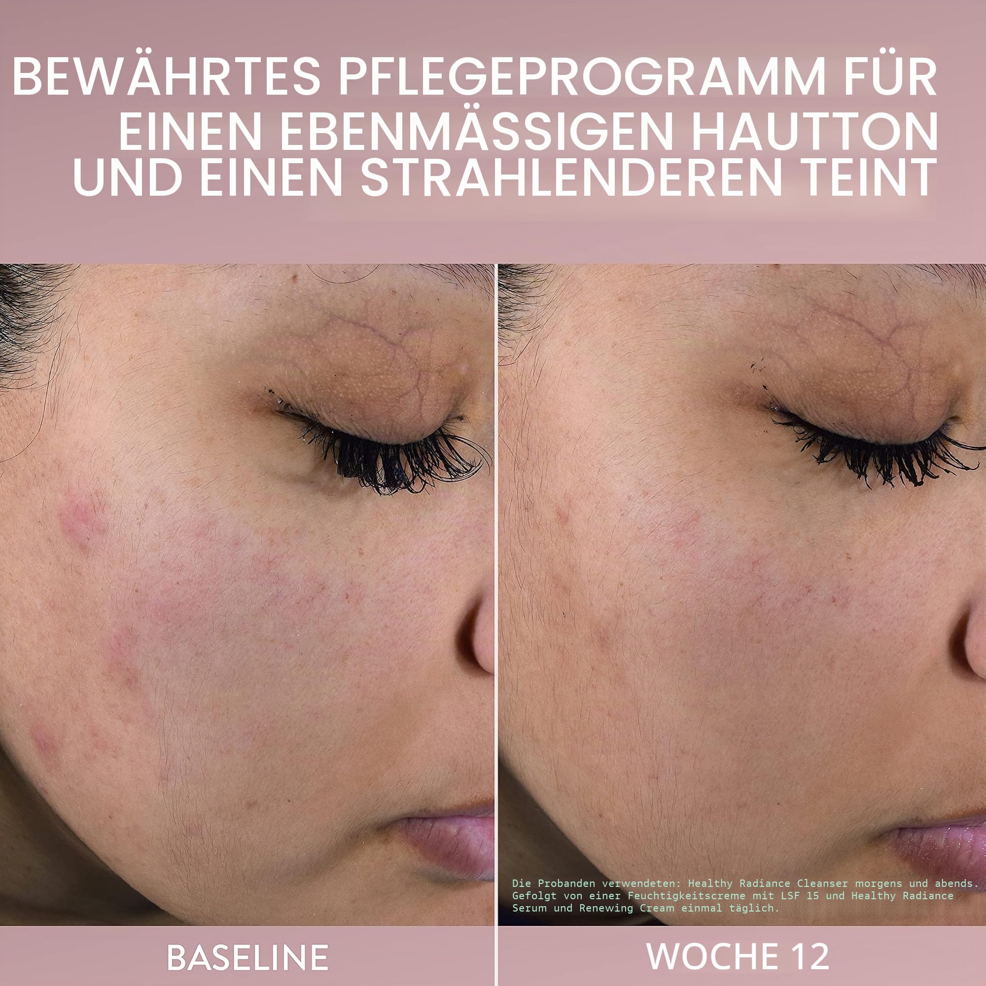 Cetaphil Gesichtsserum mit gesundem Strahlen, Antioxidantien-C-Serum, reduziert sichtbar dunkle Flecken und Hyperpigmentierung, entworfen für empfindliche Haut, hypoallergen, parfümfrei, 28 ml