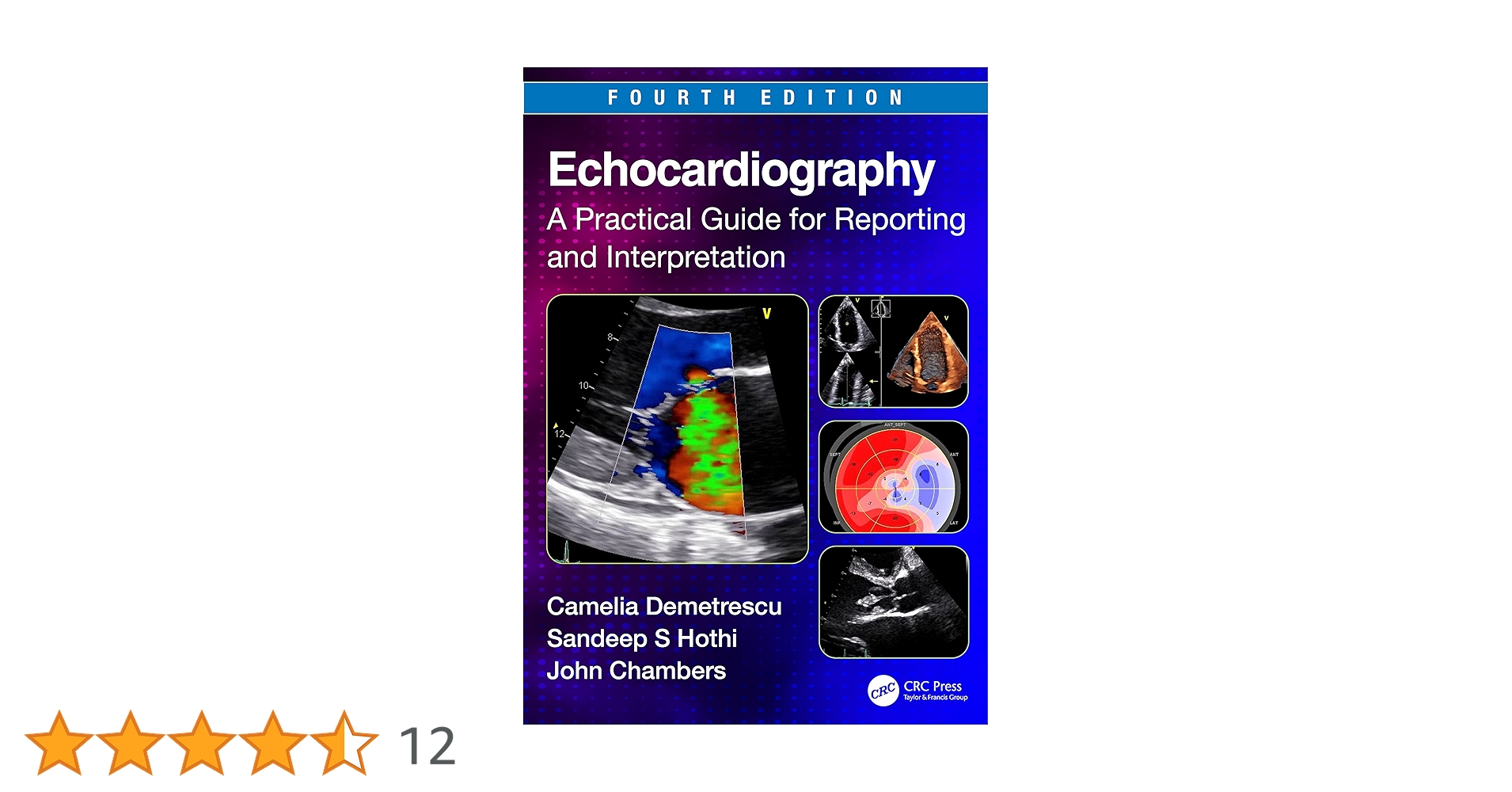 洋書 Essential Echocardiography A Practical G Buy ECHOCARDIOGRAPHY A PRACTICAL GUIDE FOR REPORTING AND