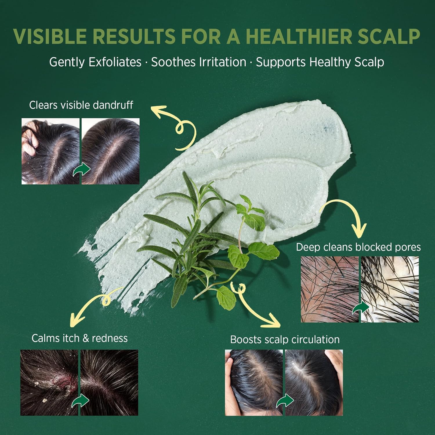 RoyceDerm Rosemary Mint Scalp Scrub with Scalp Massager Brush Hair Scrubber Bundle - Supports Hair Growth, Oil Control, Scalp Care and Deep Cleansing - Image 4