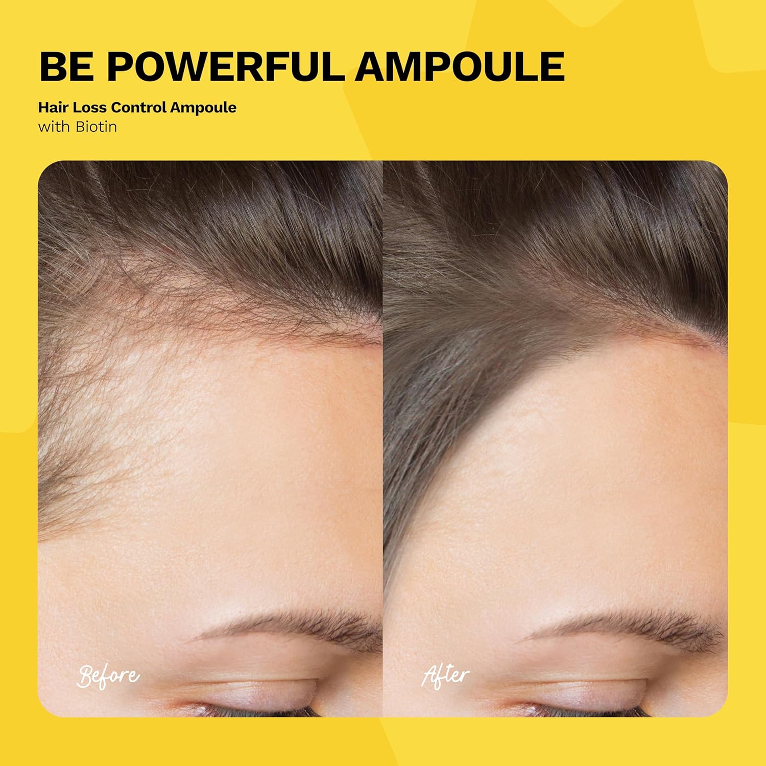 Ginger Milk Ampoule for Hair Loss Control with Biotin | Revitalizing Hair Treatment | BE POWERFUL (Pack 6 x 0.5 fl oz)