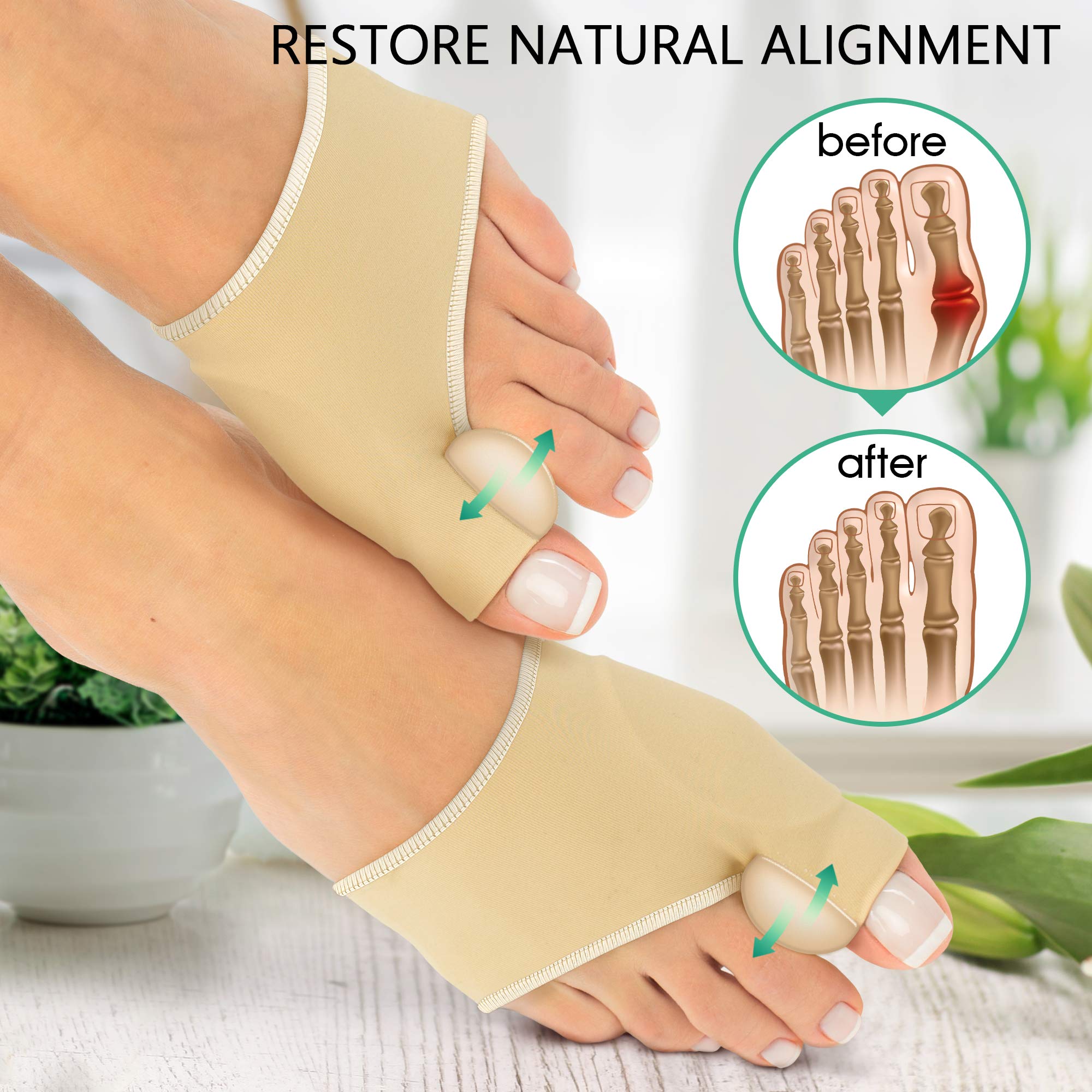 Buy Bunion Corrector (2PCS) Orthopedic Bunion Splint NonSurgical