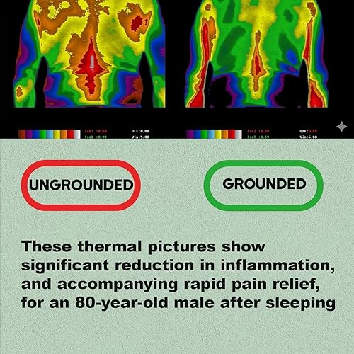 Miniatura 6 de Sábanas de tierra, 10 % fibra de plata pura + 90 % algodón orgánico, sábana bajera de media tierra, talla única para todas las camas (gris, 24 x 108