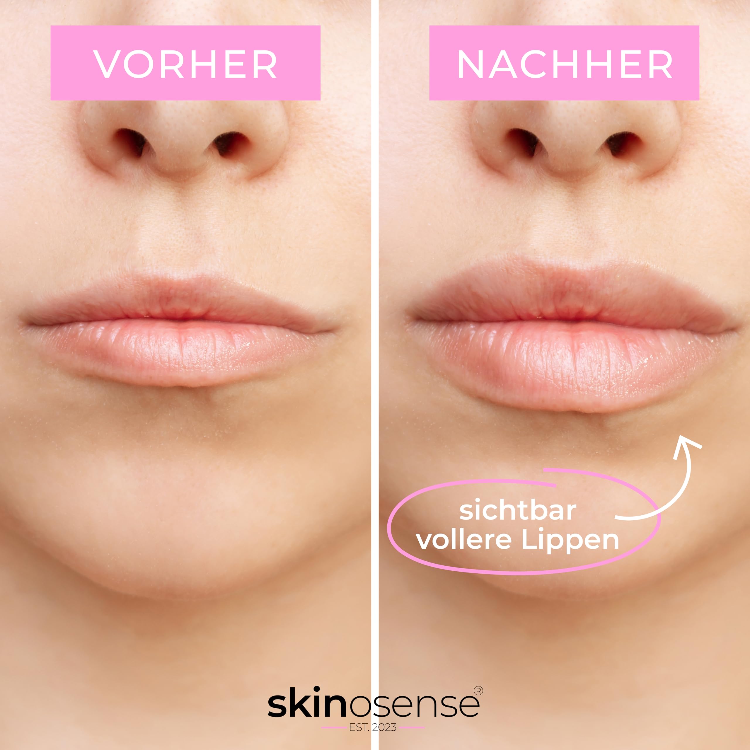 Lip Booster Set – Hydra Derma Roller 3.0 & Serum 30ml | Für sichtbar vollere Lippen – Vegan & Tierversuchsfrei