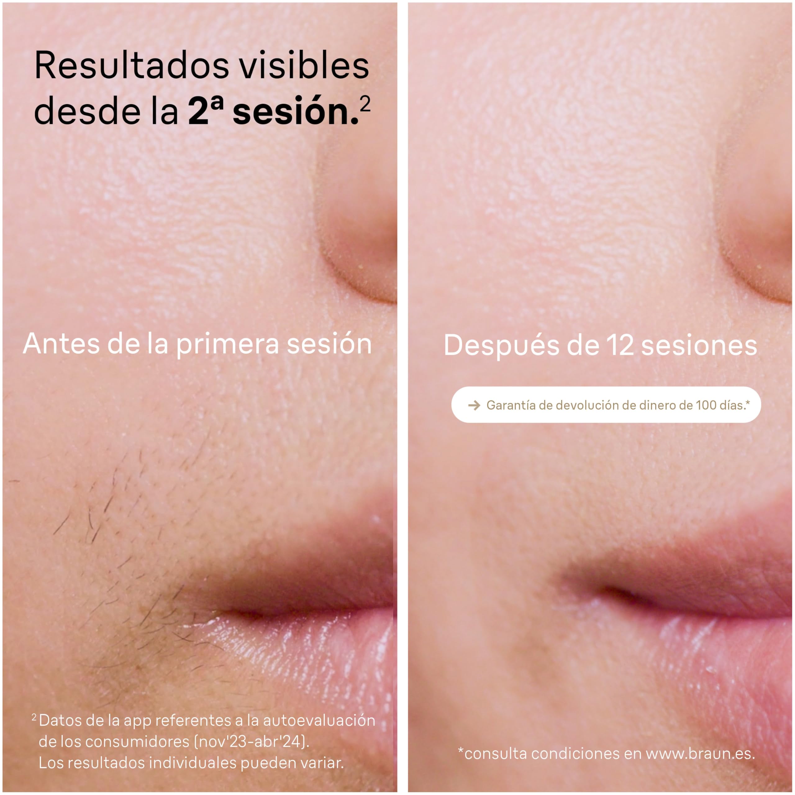 Braun Depiladora Luz Pulsada Silk-expert Pro 5, PL5140, Blanca/Dorada - Alternativa a Depiladora Laser, IPL Con Funda y 2 Cabezales Para Cara y Cuerpo, Eliminación Del Vello En Casa