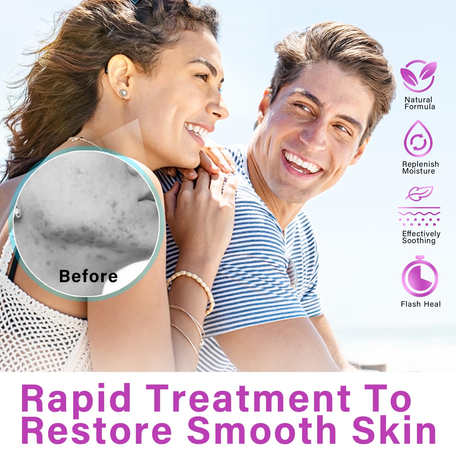 Siero Al 12% Di Acido Azelaico, Combatte Acne E Brufoli, Brufoli Invisibili, Libera I Pori, Riduce Significativamente L'Irritazione, Siero Antiacne Per La Pelle, 1 Oz