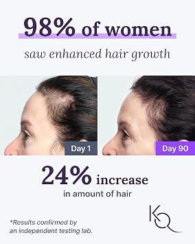 Keranique KeraViatin Hair & Scalp Health Supplement, Clinical Strength, Biotin, Vitamin B, 120 Softgels-60 Count (Pack of 2)