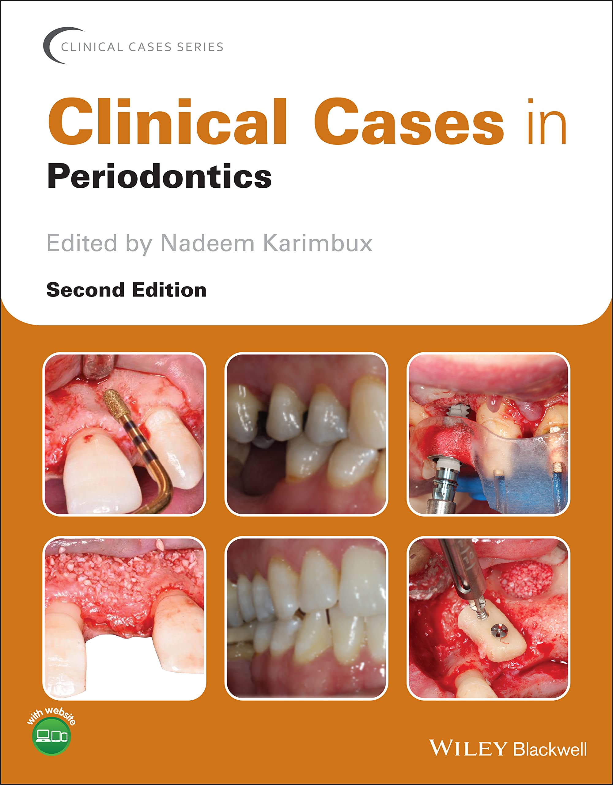 Clinical Cases in Periodontics (Clinical Cases (Dentistry