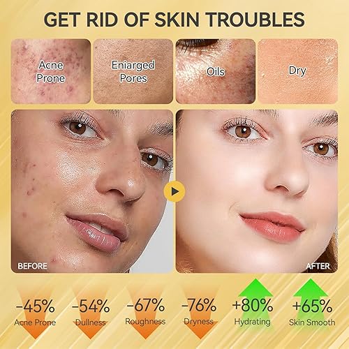 Miniatura 4 de Set de cuidado de la piel, juegos y kits revitalizantes para el cuidado de la piel de caracol facial, regalos para niñas adolescentes con limpiador,