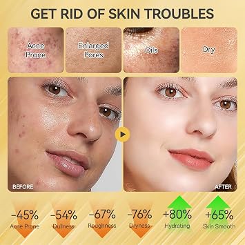 Skin Care Set, Face Snail Revitalizing Skin Care Sets & Kits, Facial Beauty Skincare Gifts for Teenage Girls with Cleanser,Toner,Serum,Eye Cream,Face Cream, Firming Hydrating Skin Care Christmas Gifts