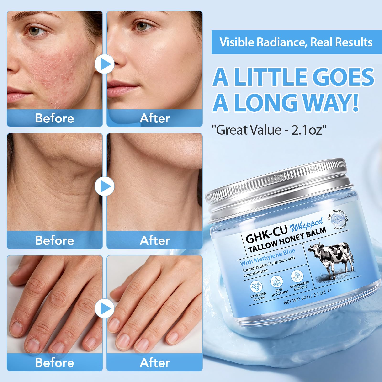 ghk cu diabetes GHK-Cu may Prevent Oxidative Stress in Skin by Regulating Copper and  Modifying Expression of Numerous Antioxidant Genes