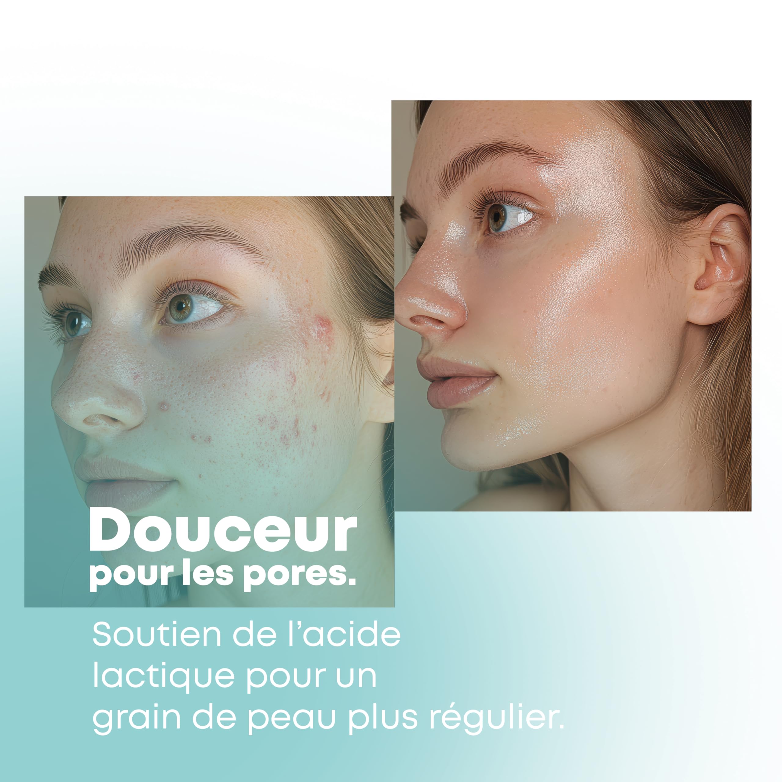 PhytoFlora Savon Lait de Chevre|125g|Traitement Anti-Acné, Eczéma et Points Noirs|Shampoing Solide|Gommage Visage|Savon le Naturel|Tous Peaux|ProvitamineB5