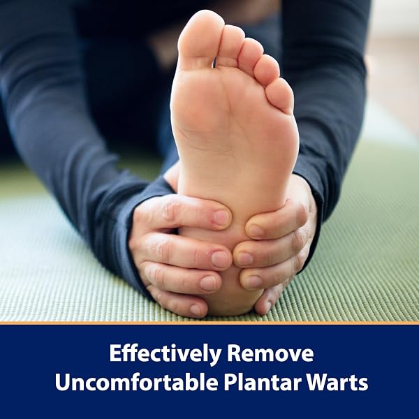 Compound W Wart Remover One Step Medicated Foot Pads- 20 Count - With Salicylic Acid, Maximum Strength, Effective Wart Removal One Step Foot Pads Pads - 3