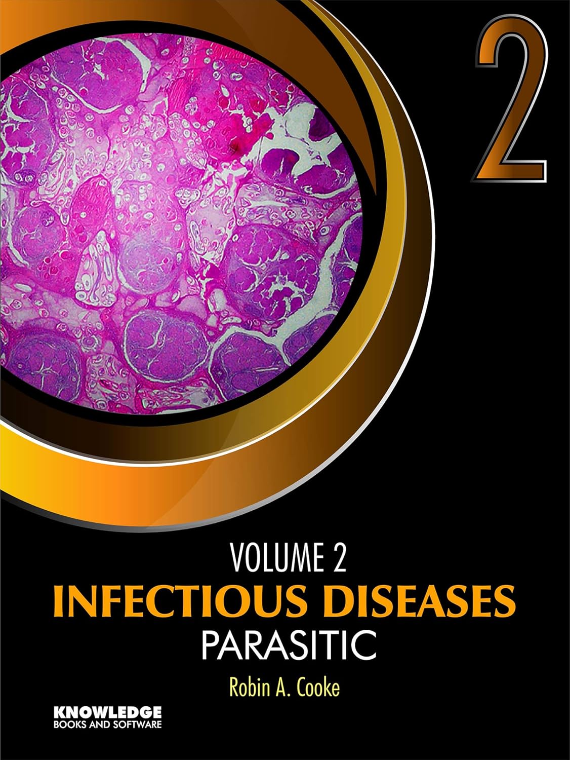 Infectious Diseases: Parasitic : Volume 2      [Print Replica] Kindle Edition