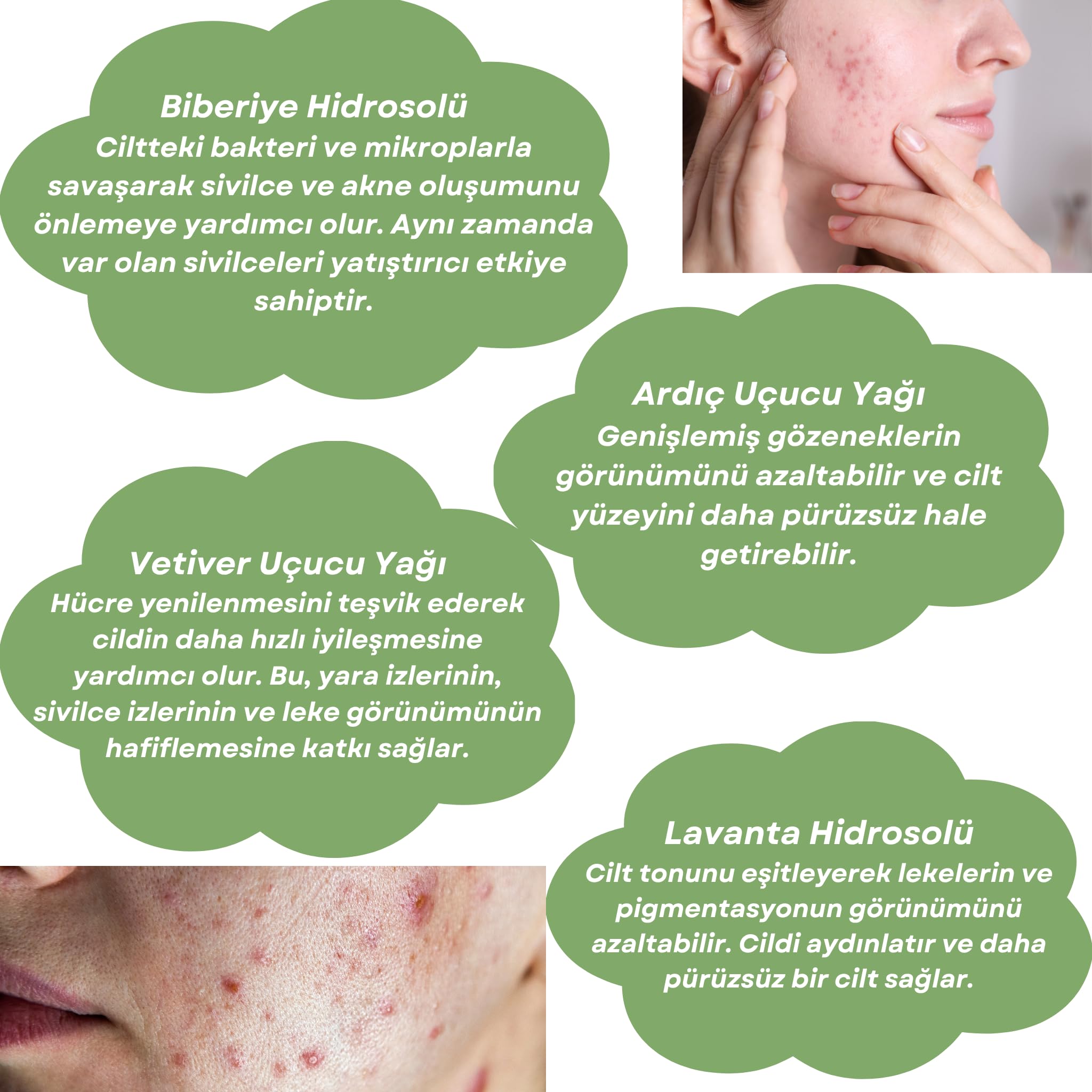 Skin Care Toner | ARINDIRICI & YATIŞTIRICI CİLT BAKIM SUYU | Biberiye, Ardıç, Lavanta ve Vetiver İçe