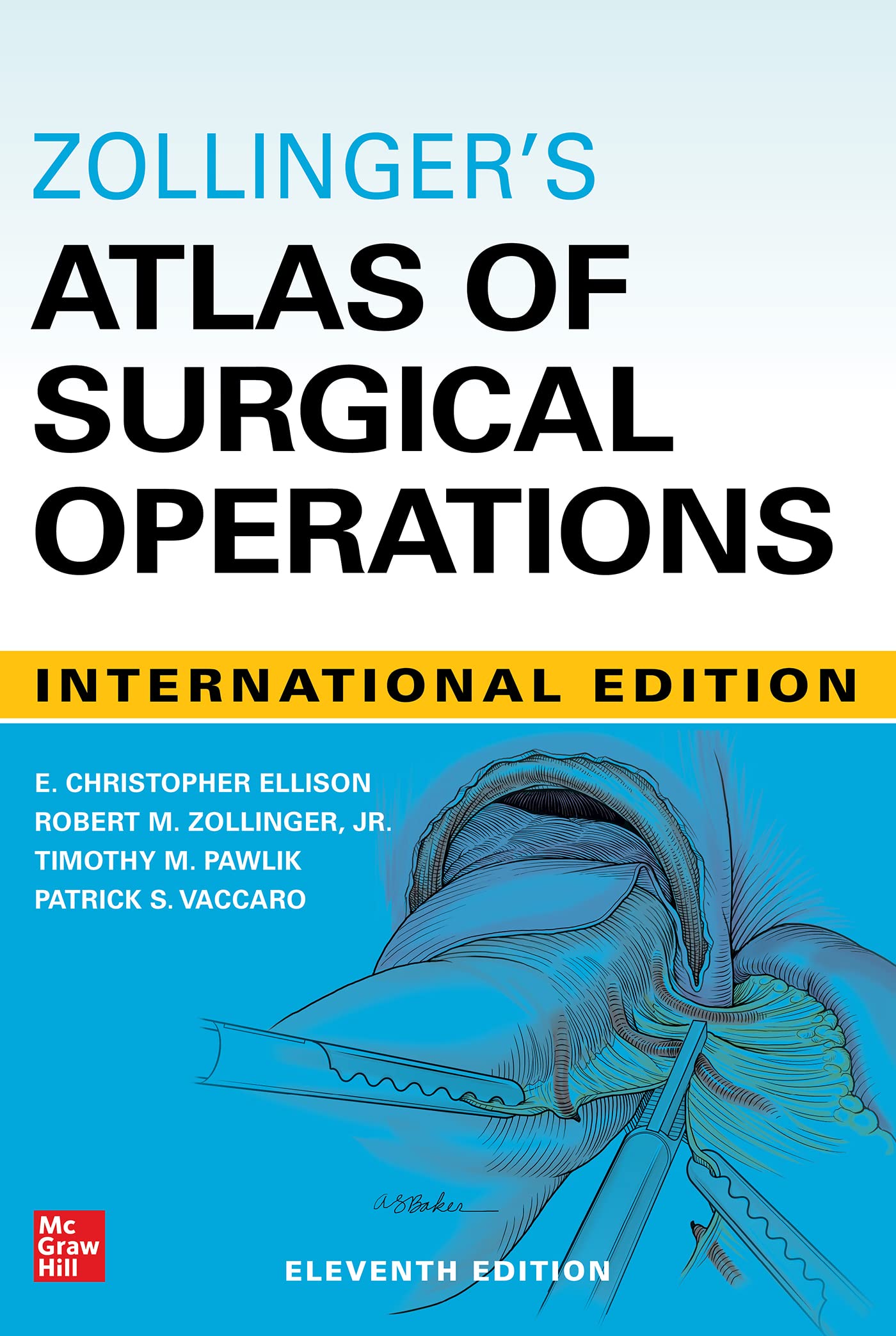 健康・医学 Zollinger's Atlas of Surgical Operations ZOLLINGER'S ATLAS OF SURGICAL OPERATIONS : M. Zollinger, Robert