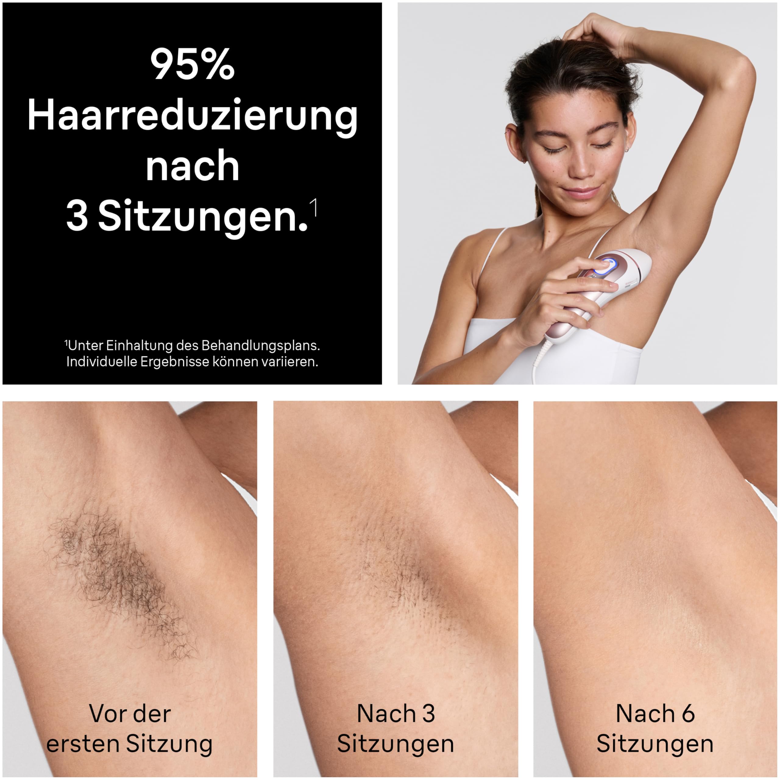 Braun Smart IPL Geräte Haarentfernung Skin i·expert 7, PL7431, Weiß/Rosegold - Alternative Laser Haarentfernung für Zuhause, Dauerhafte Haarentfernung, Inkl. Etui, Venus Rasierer Und 4 Aufsätze