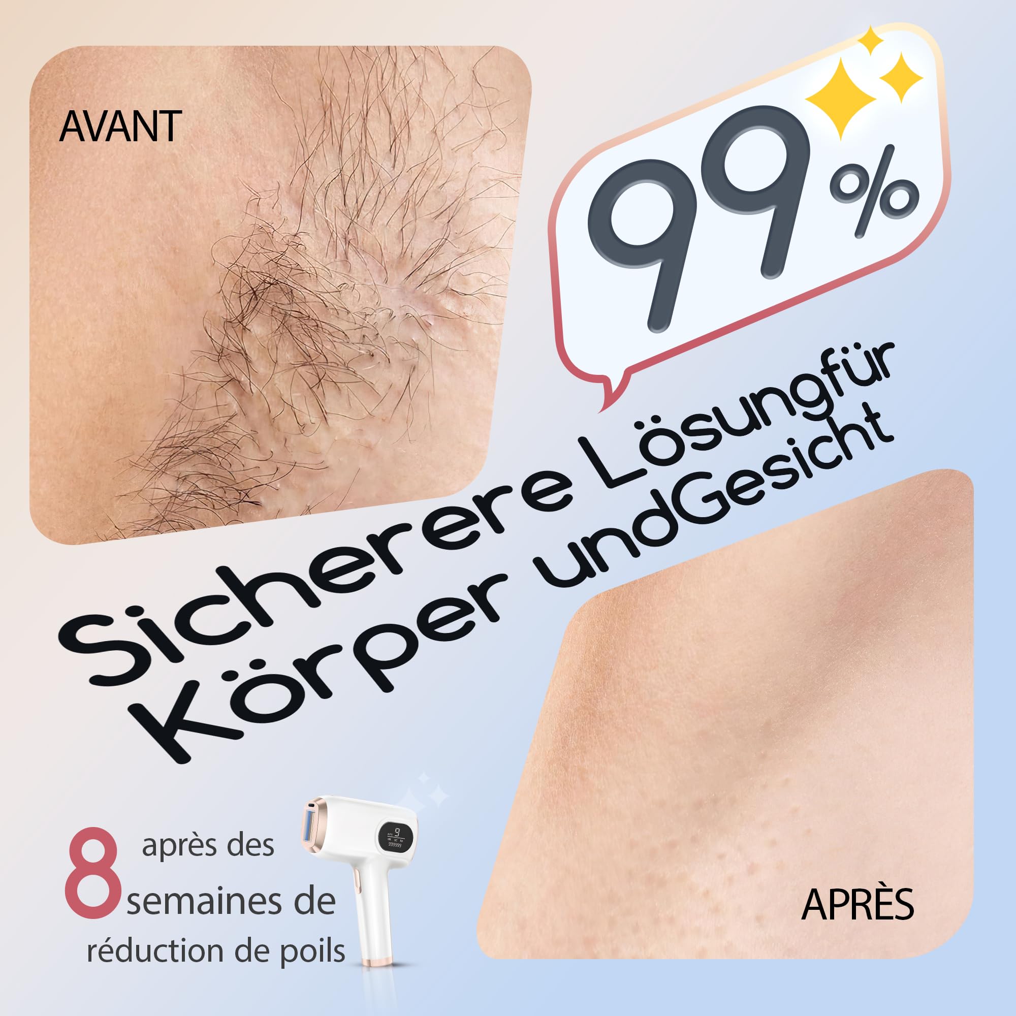 Épilateur Lumière Pulsée, Fonctions HR/SR/HR+, 9 niveaux d'énergie, 999 999 impulsions lumineuses, des femmes, des lèvres, du visage, des aisselles et du corps.